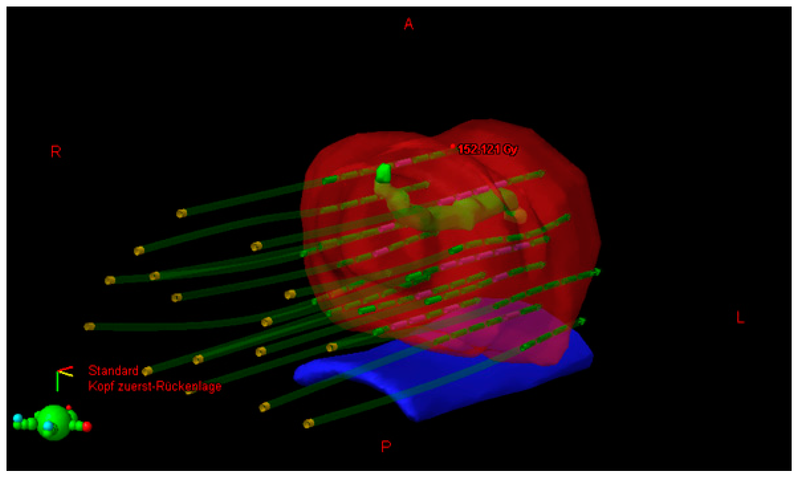 Ijms 17 01879 g002 550
