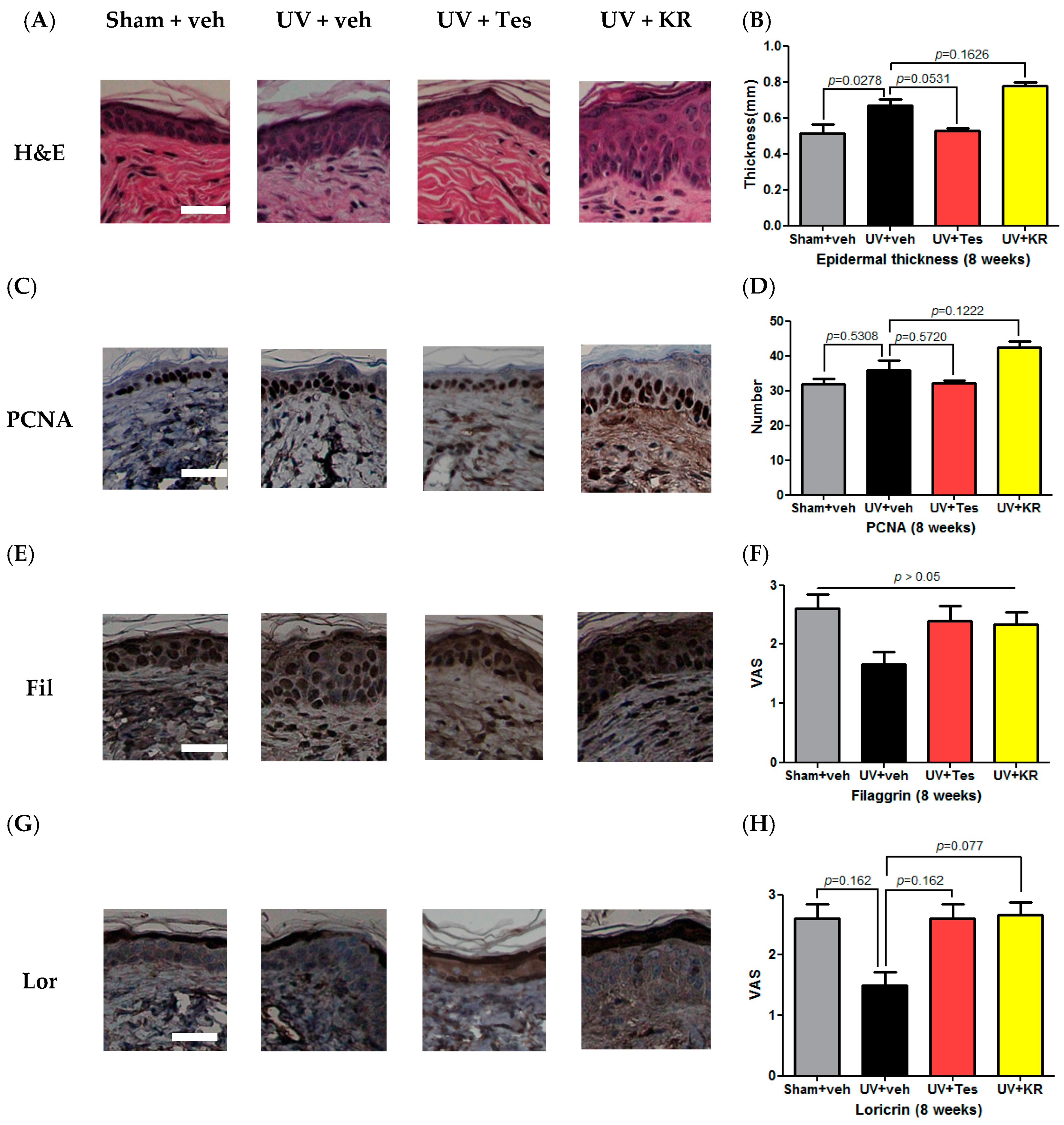 Ijms 17 01919 g008 550