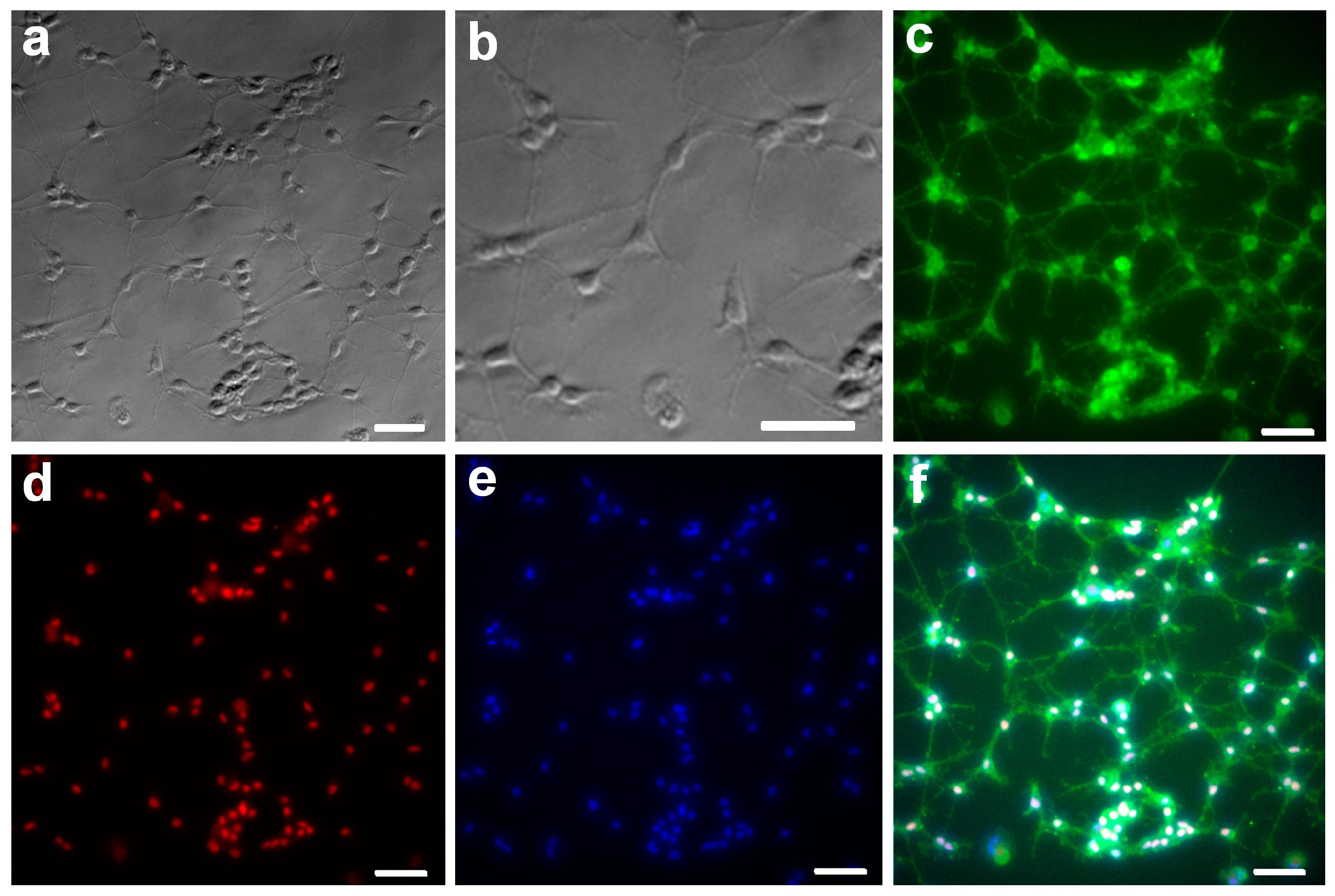 Ijms 17 01948 g001 550