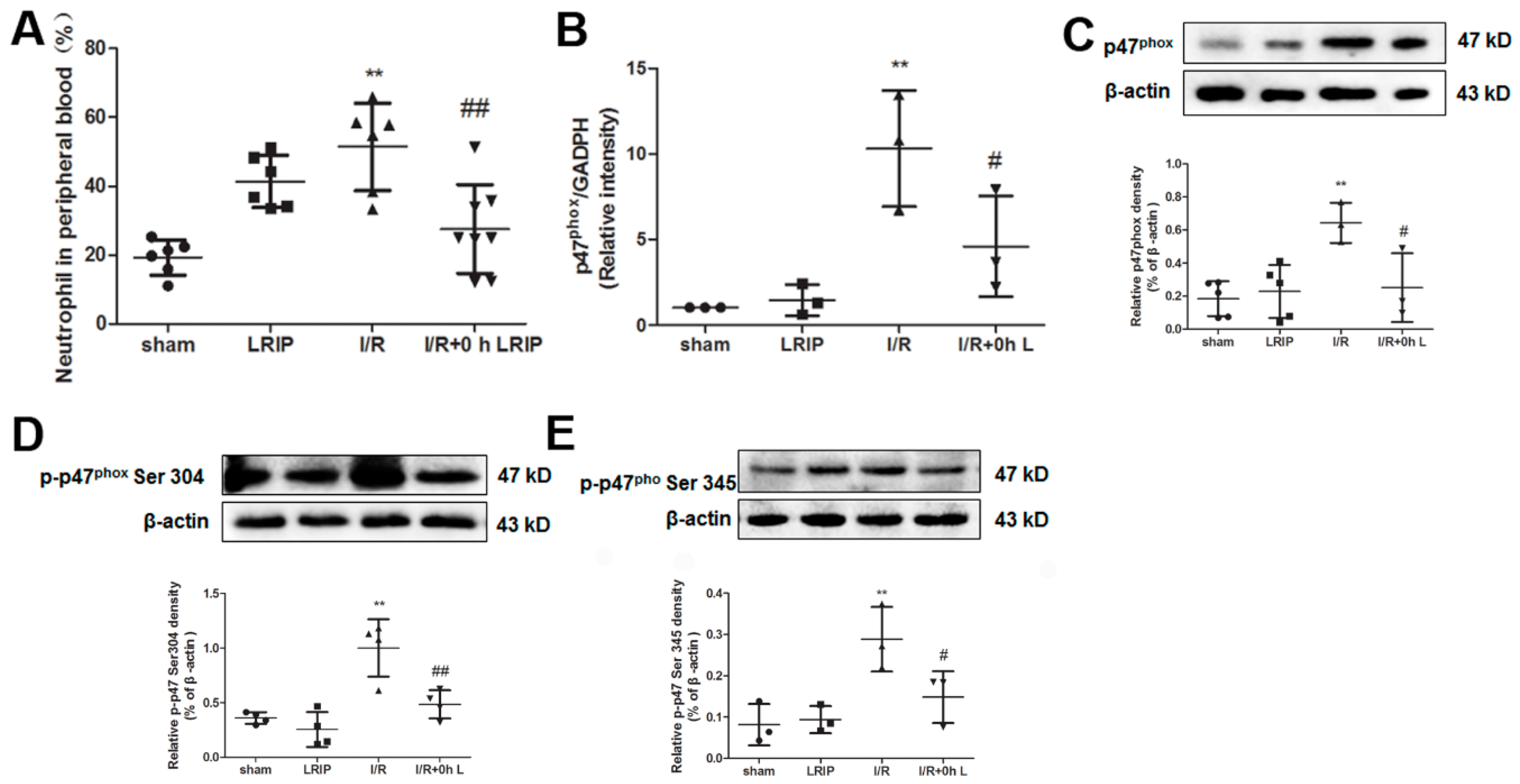 Ijms 17 01971 g005 550