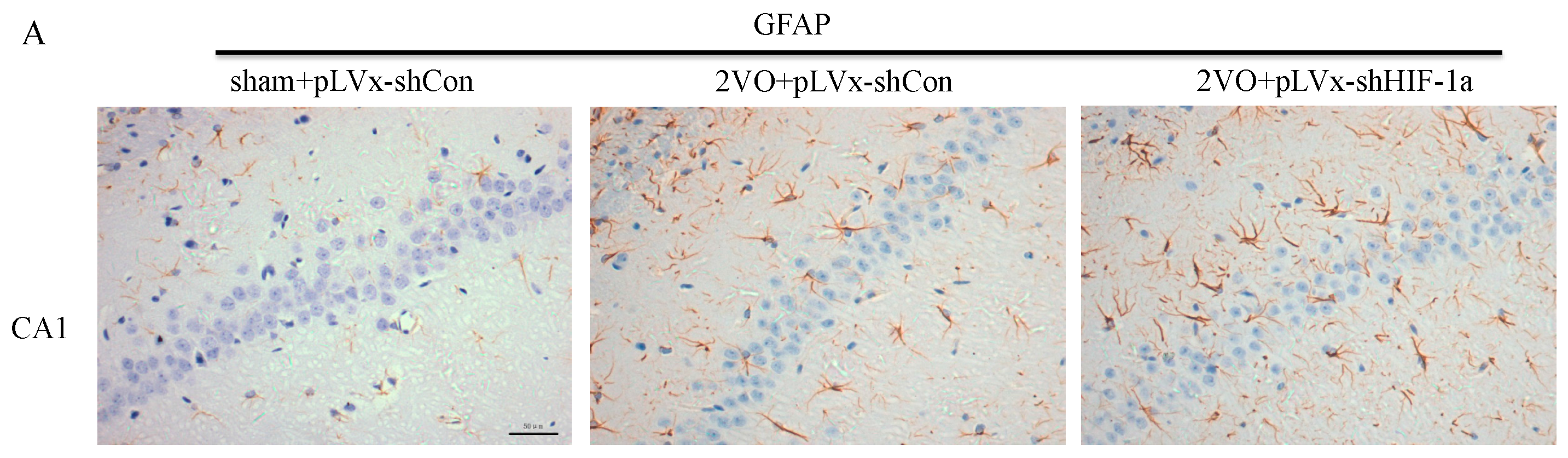 Ijms 18 00003 g006a 550