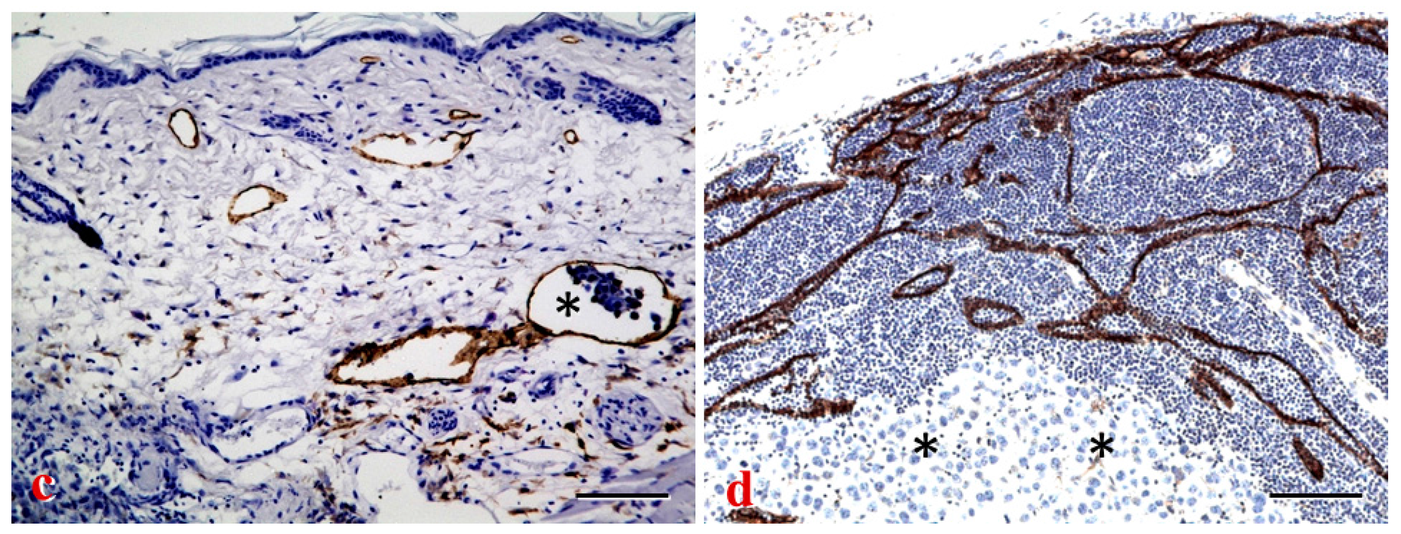 IJMS | Free Full-Text | Lymph Nodes and Cancer Metastasis: New