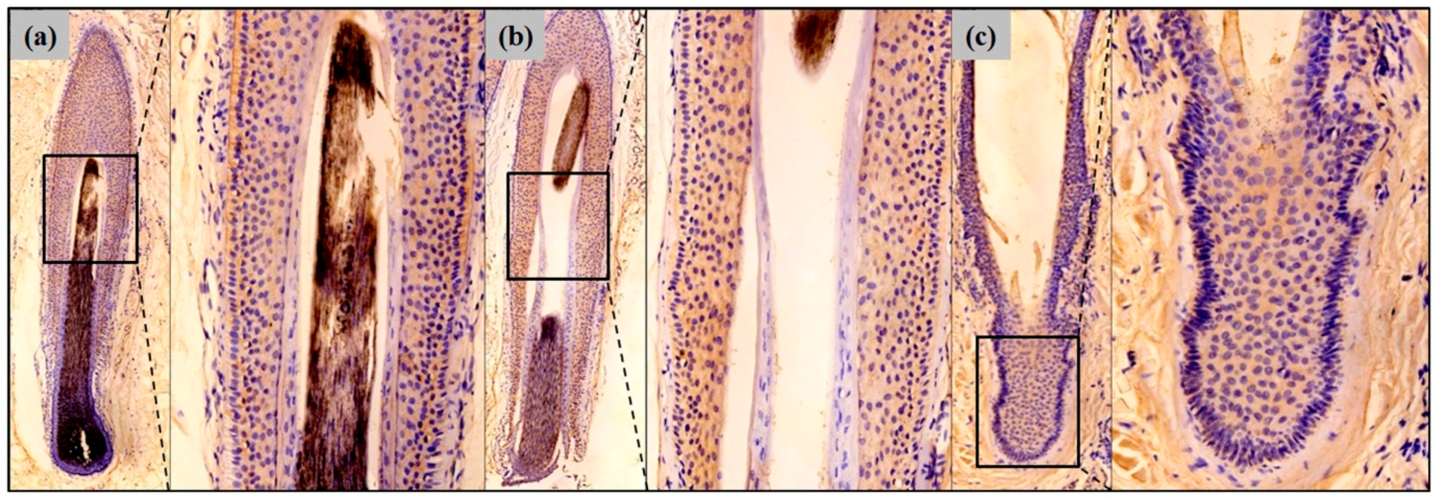 Ijms 18 00316 g002 550
