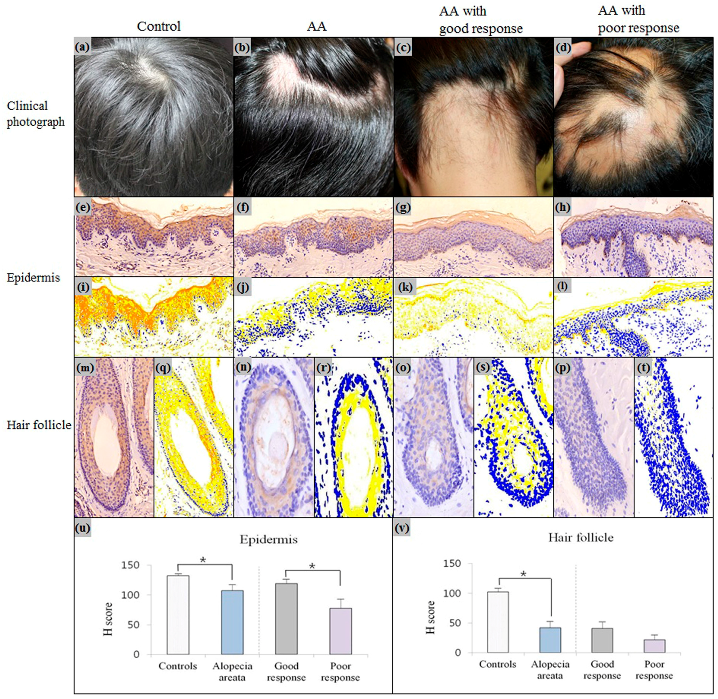Ijms 18 00316 g003 550