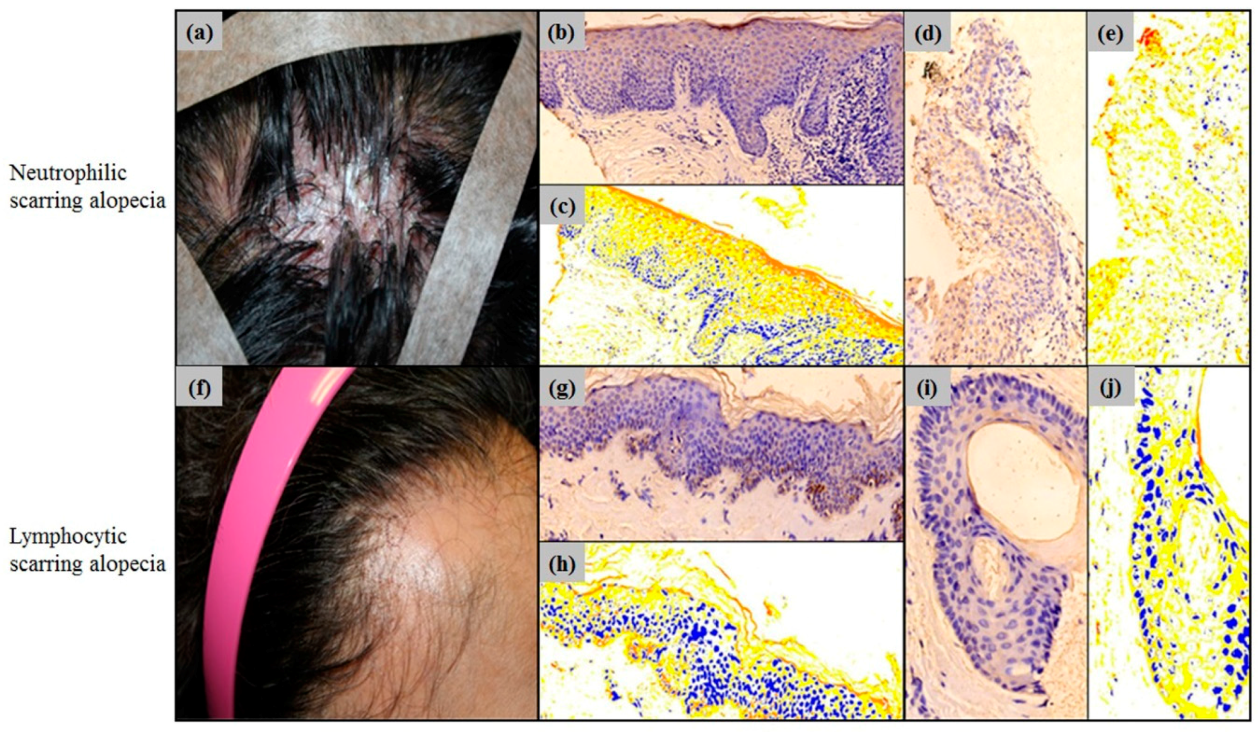 Ijms 18 00316 g005 550