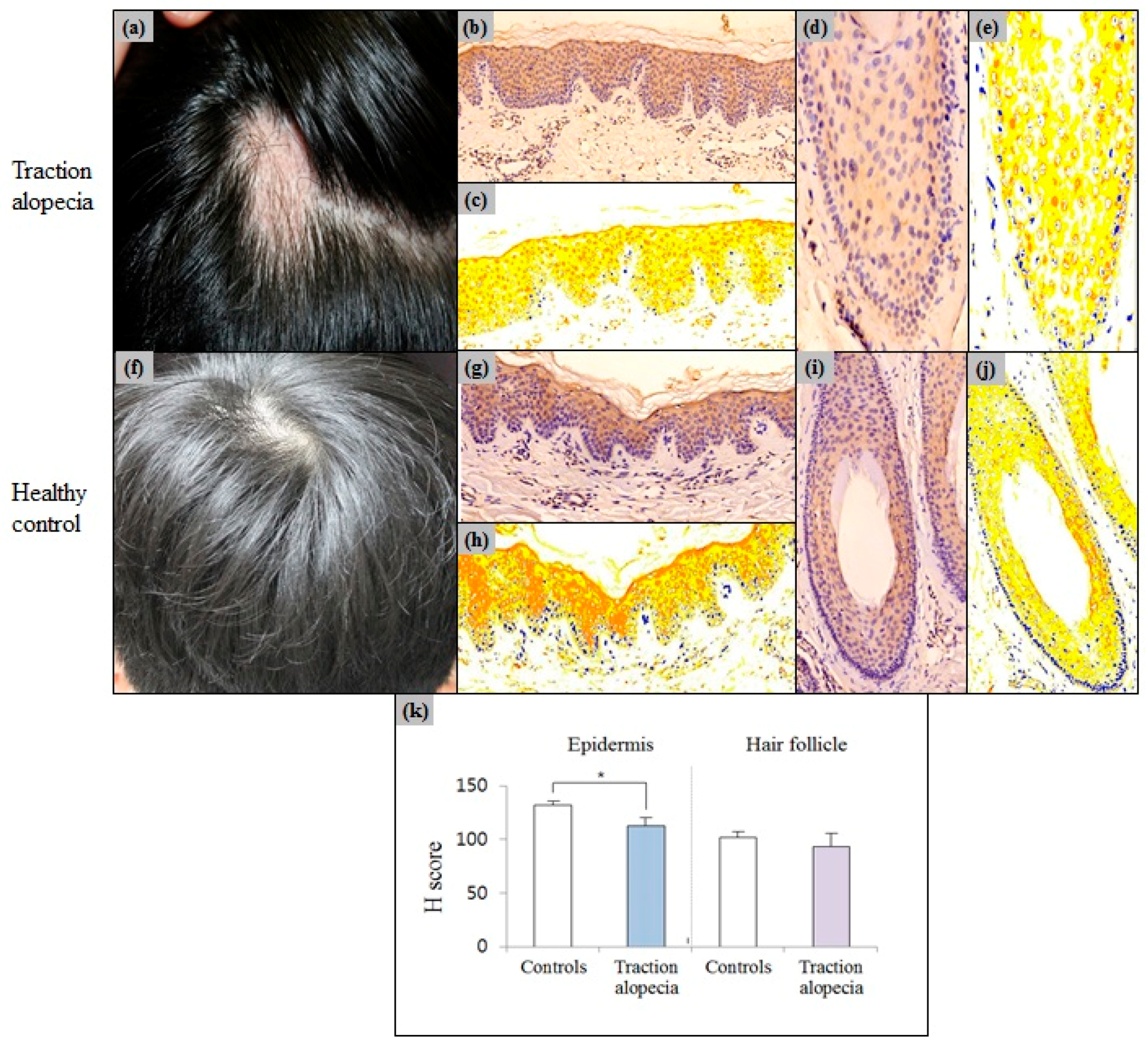 Ijms 18 00316 g006 550