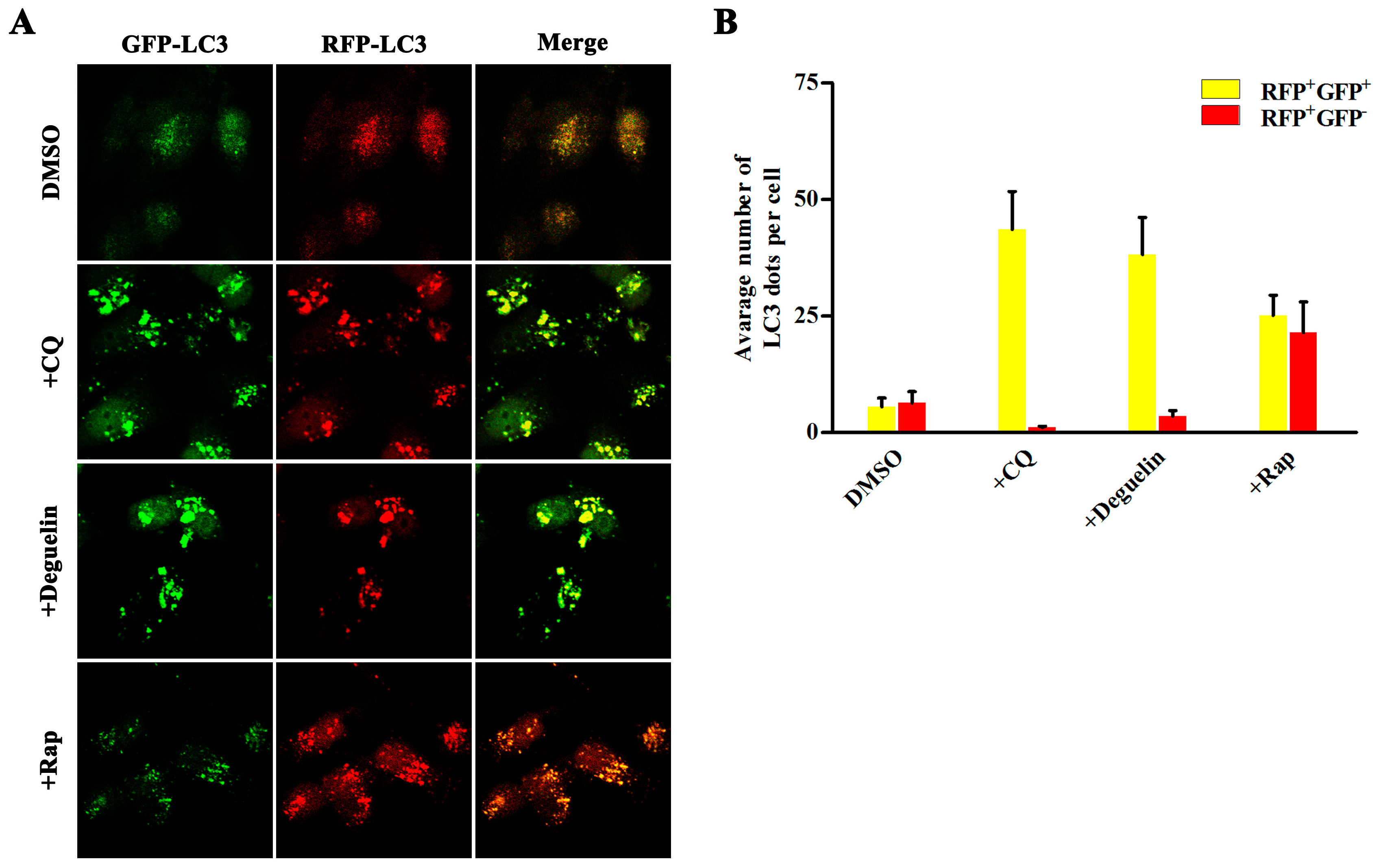 IJMS Free FullText Inhibition of Autophagy by Deguelin Sensitizes