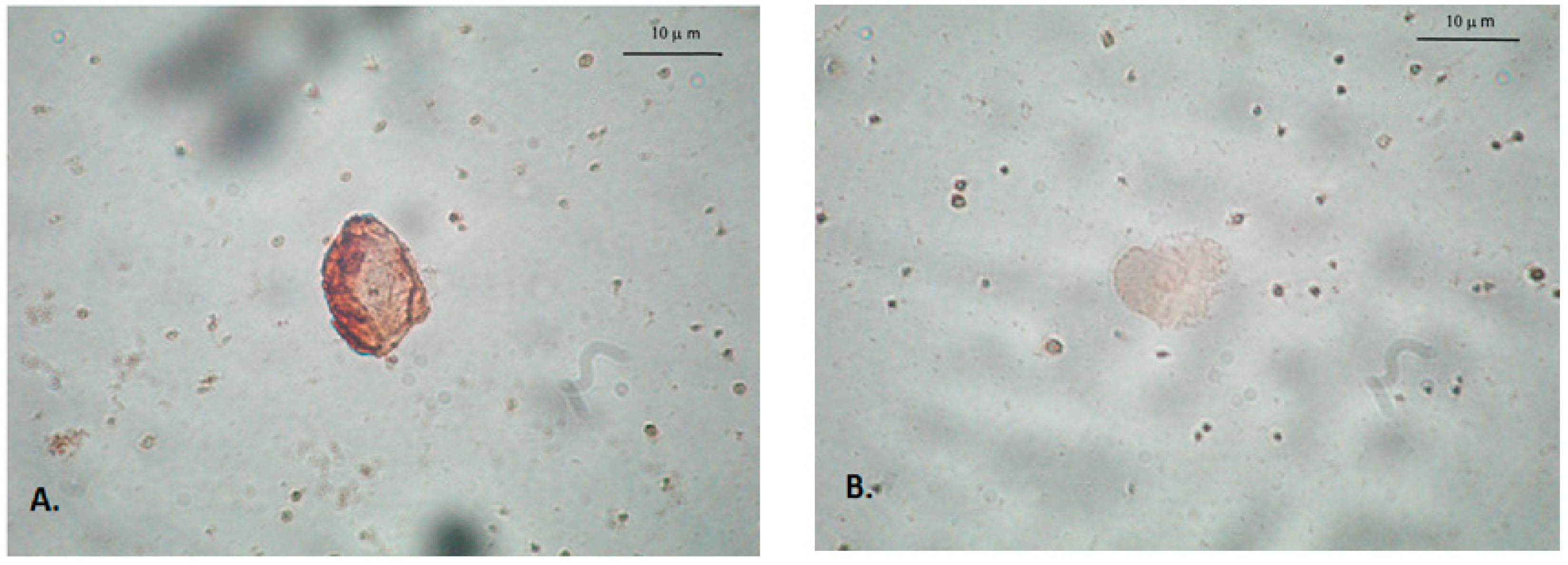 Ijms 18 00398 g001 550