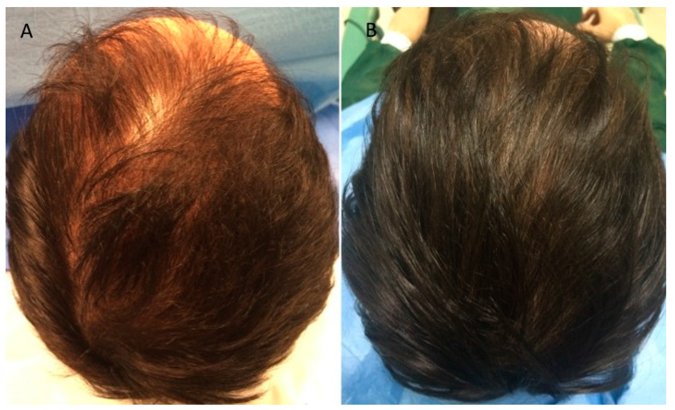 Ijms 18 00408 g003 550