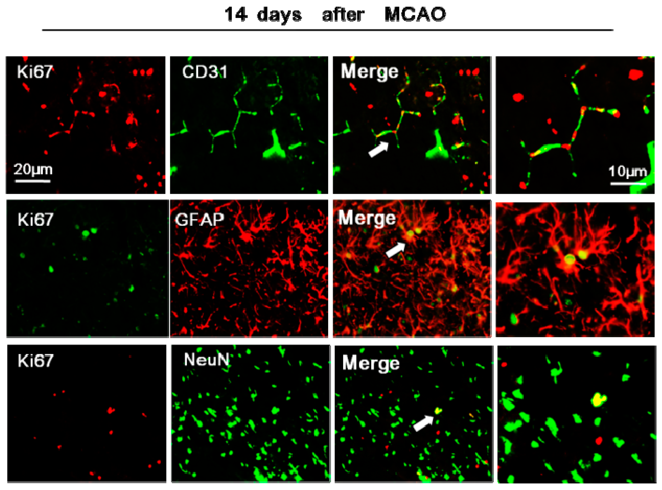 Ijms 18 00455 g004 550