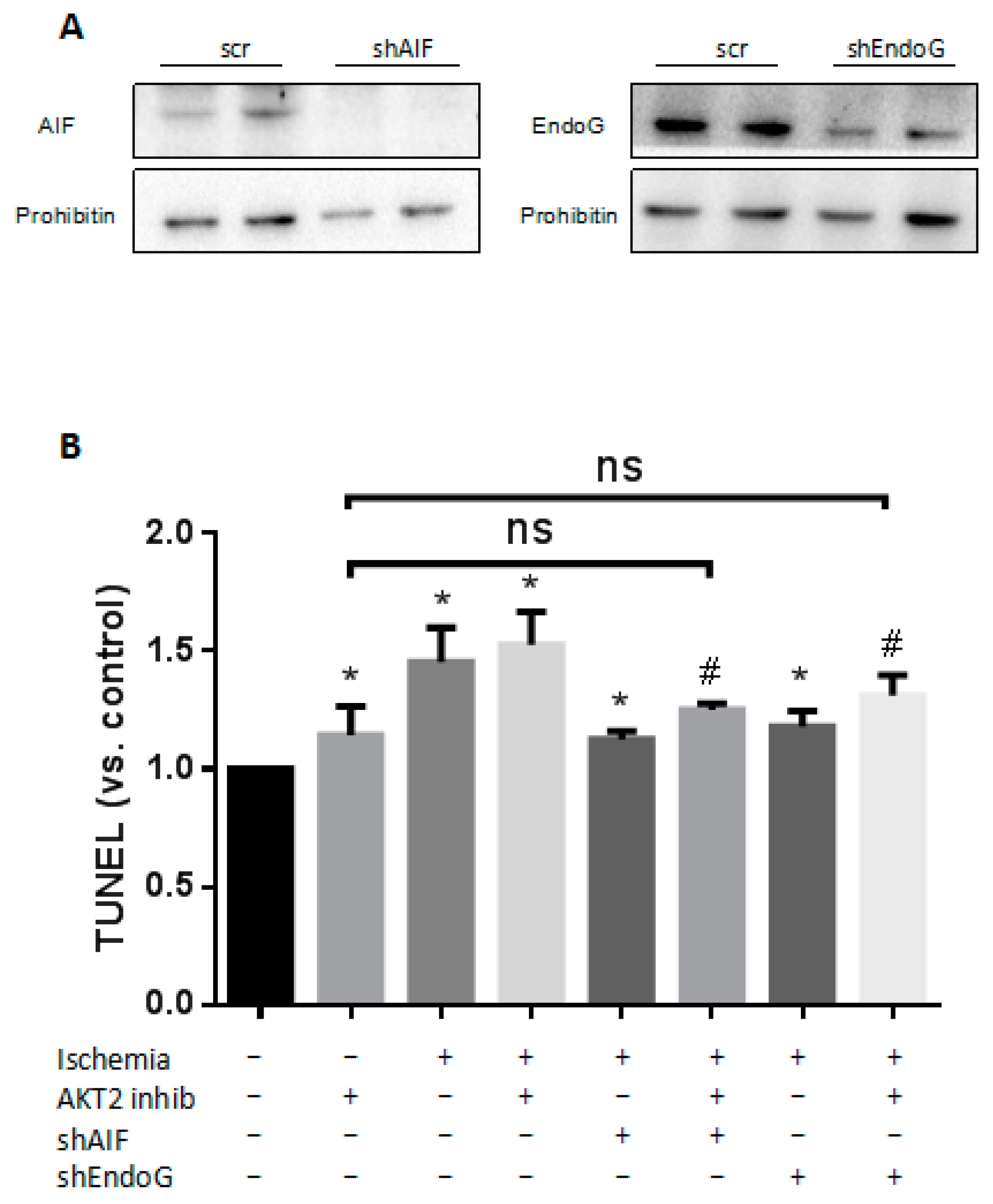 Ijms 18 00565 g006 550
