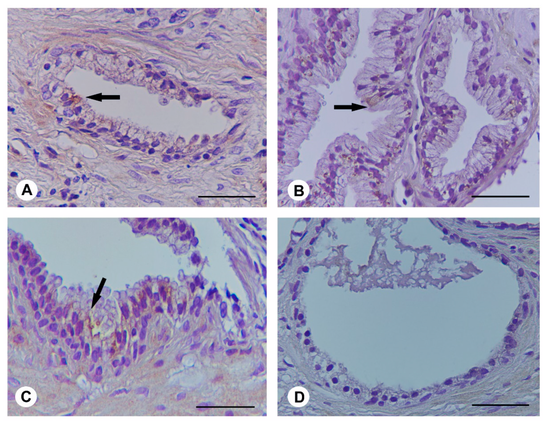 Ijms 18 00680 g004