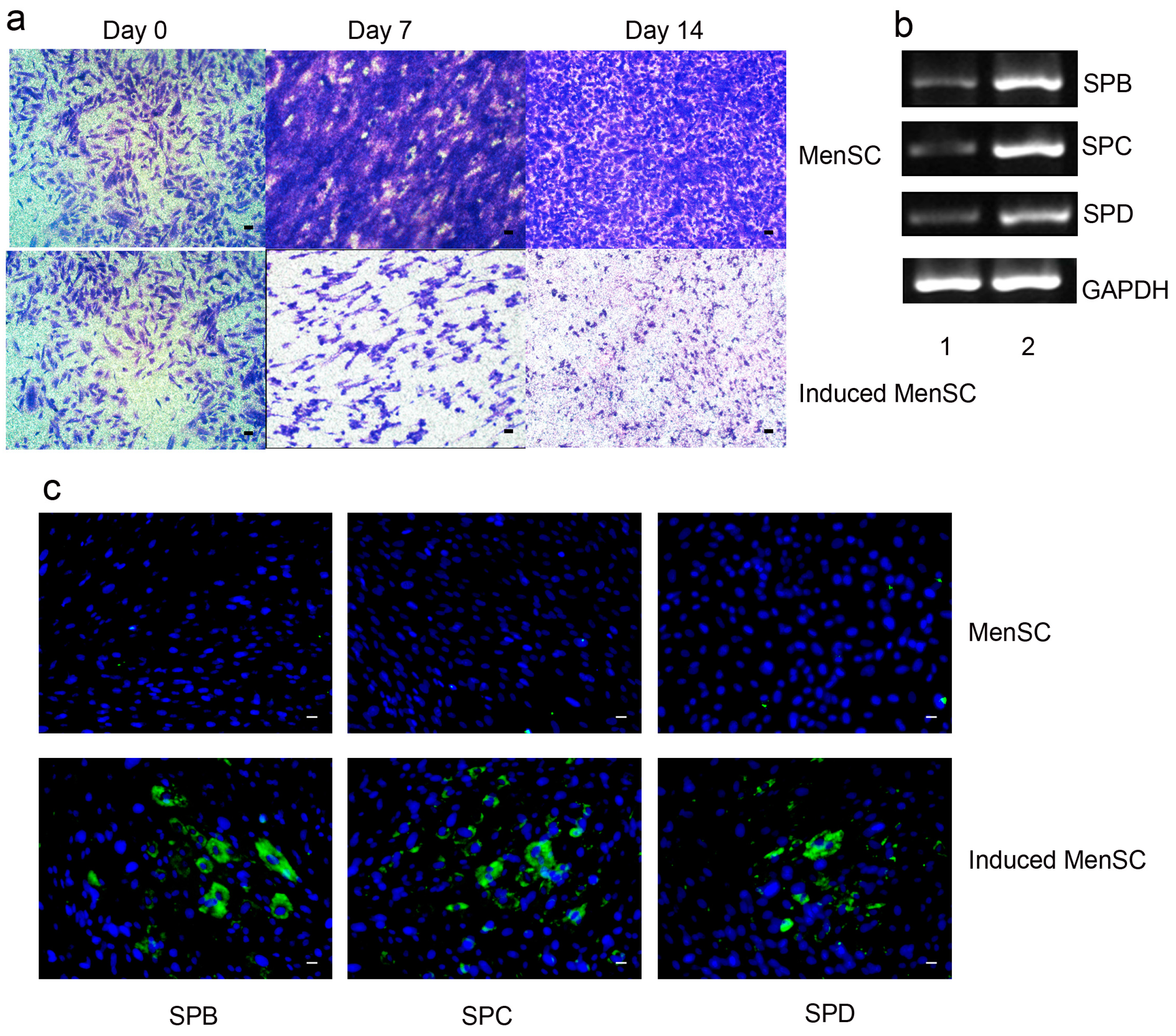 Ijms 18 00689 g004 550