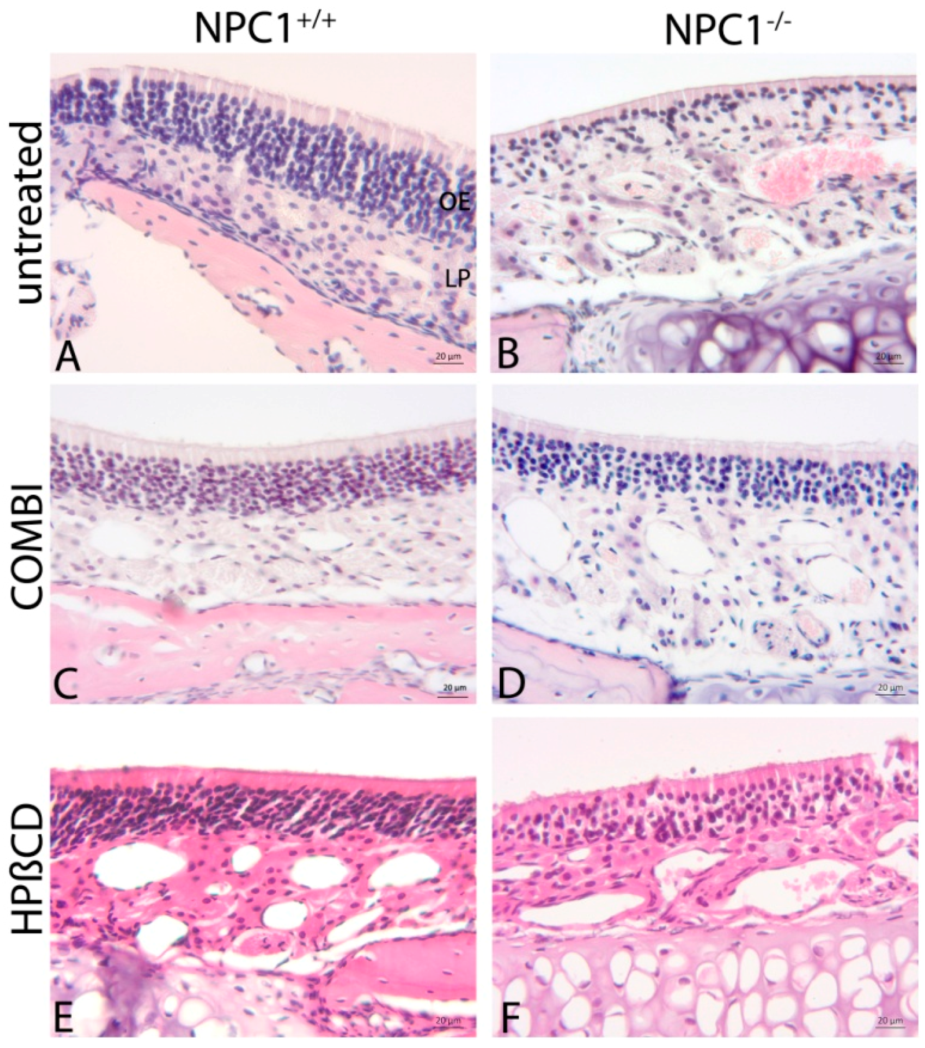 Olfactory Epithelium Histology