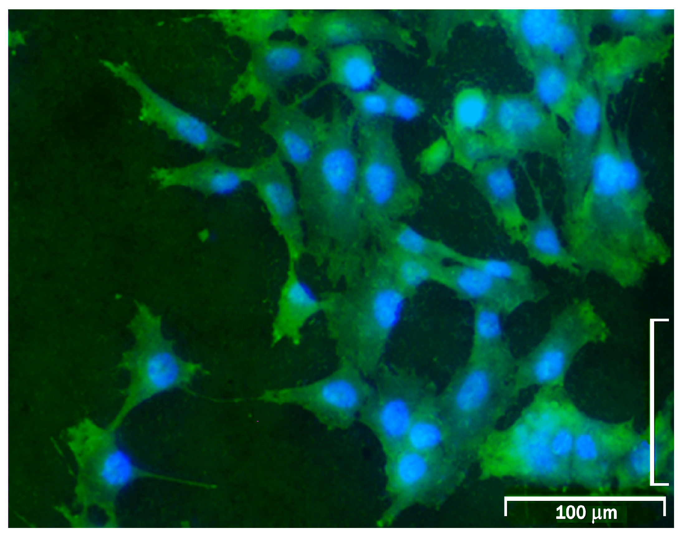 Ijms 18 00823 g004 550