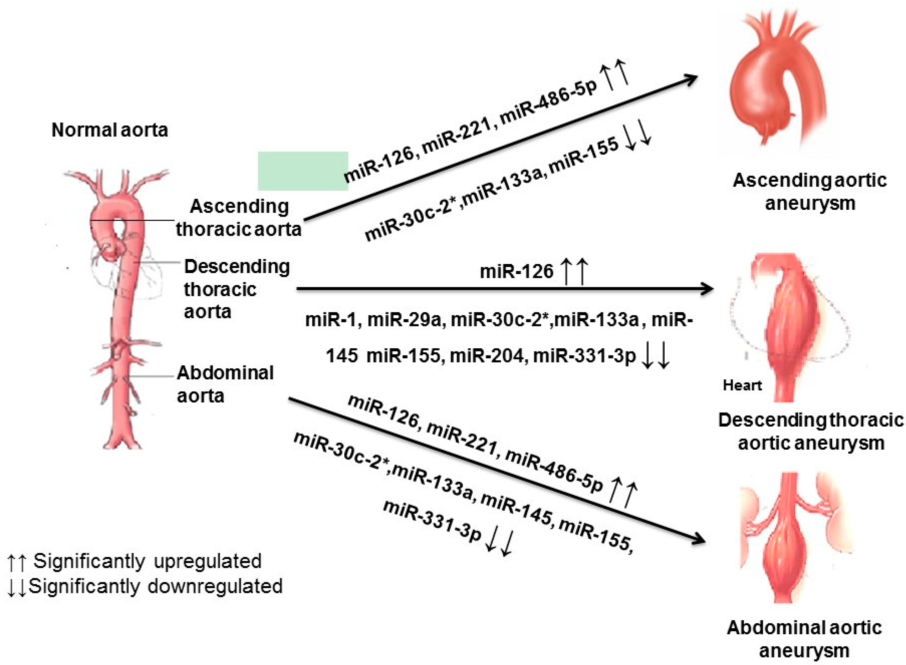 Thoracic Aorta Size Chart