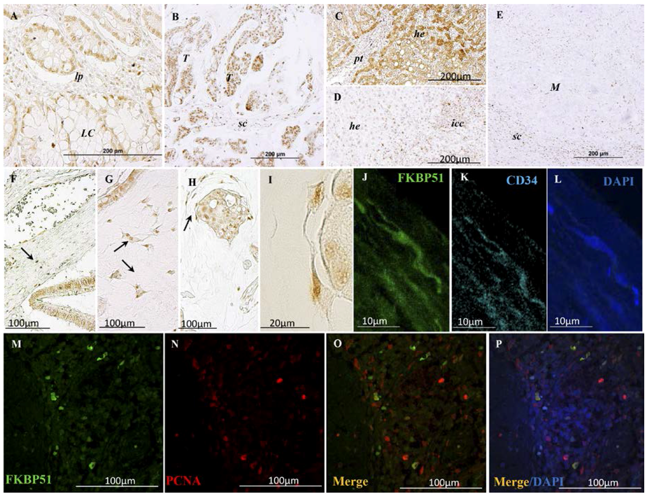 Ijms 18 00891 g005 550