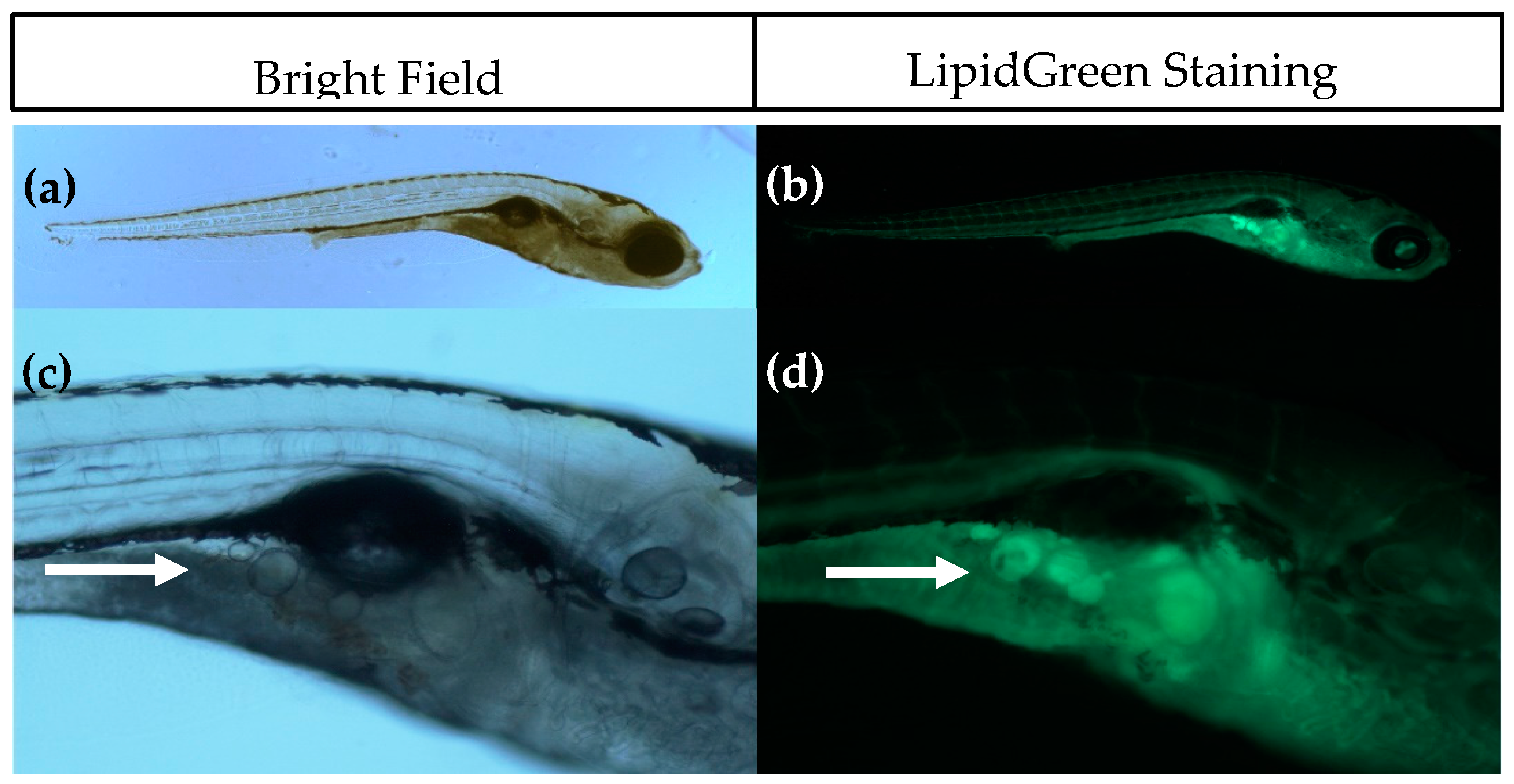 IJMS Free FullText Altered Adipogenesis in Zebrafish Larvae