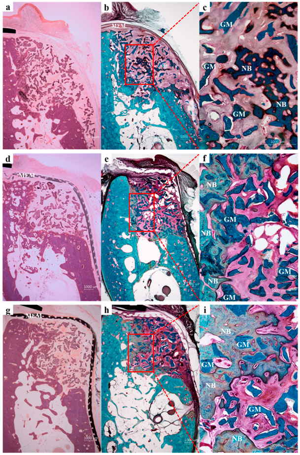 Ijms Free Full Text Effects Of 3d Printed Polycaprolactone B Tricalcium Phosphate Membranes On Guided Bone Regeneration Html