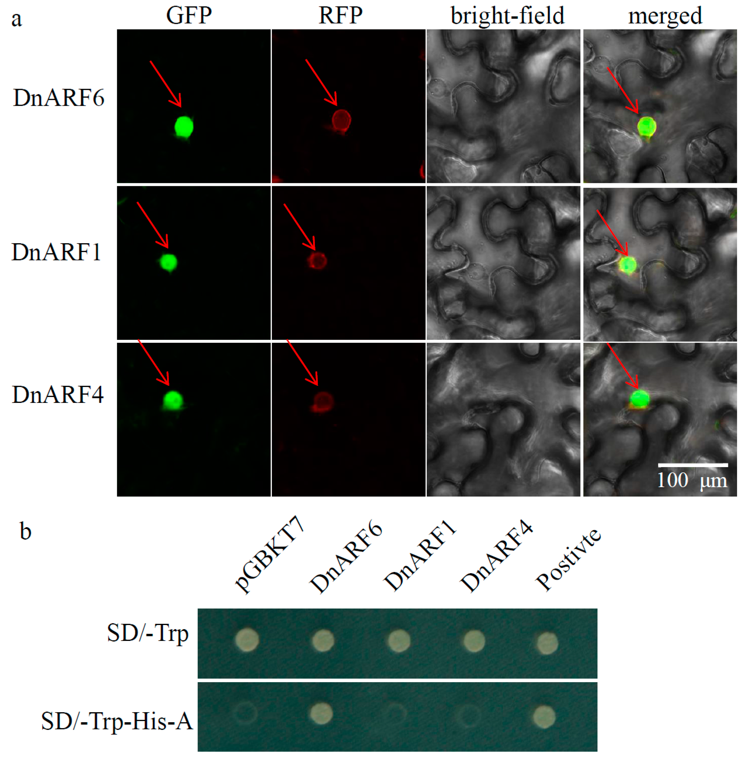 Ijms 18 00927 g005 550