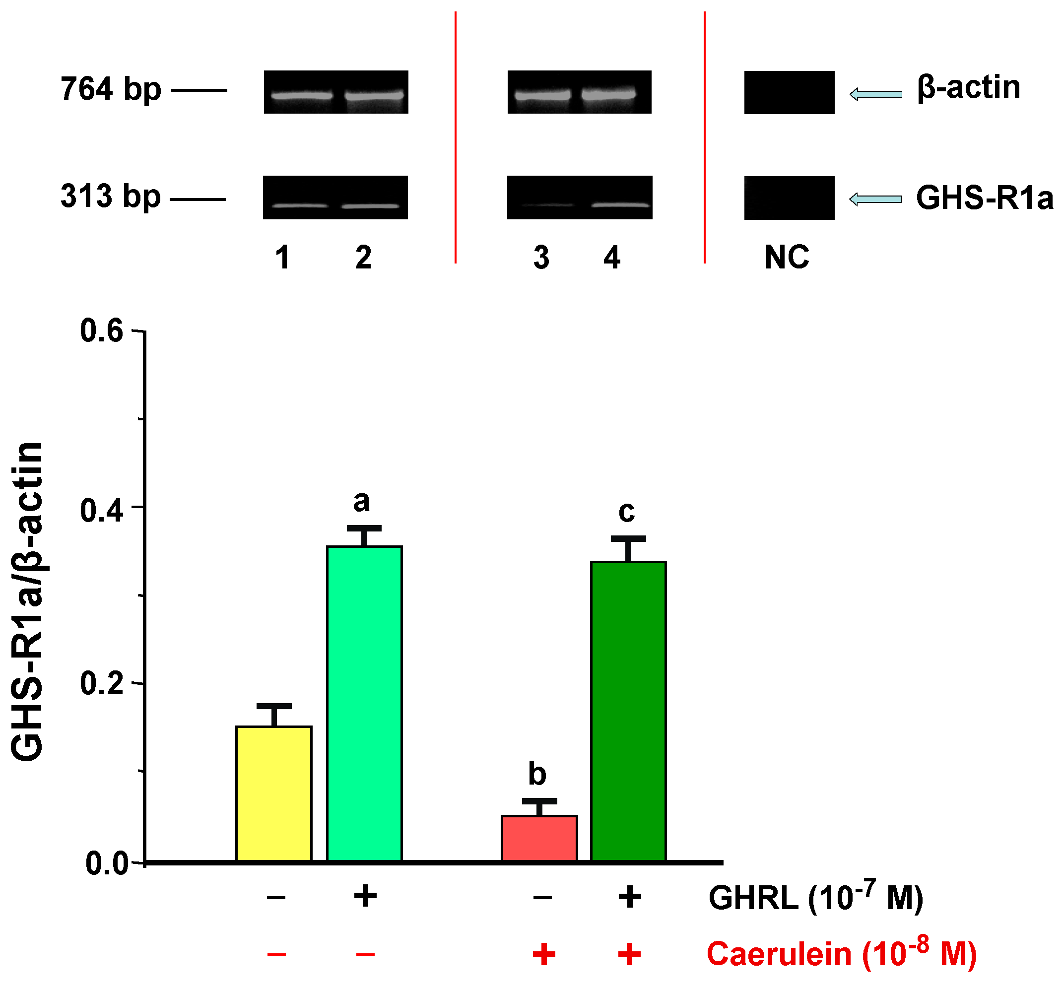 Ijms 18 00929 g005 550