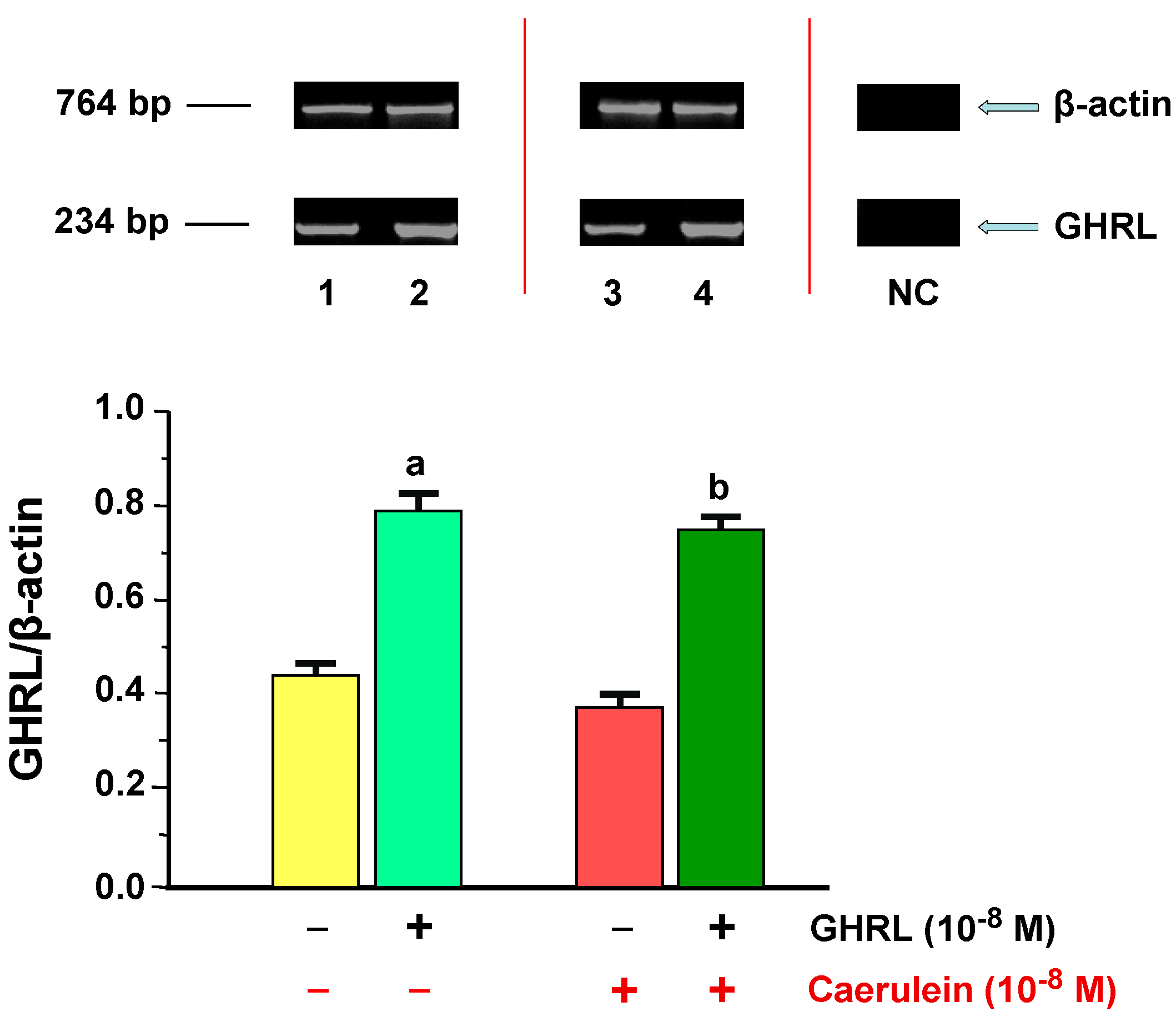Ijms 18 00929 g007 550