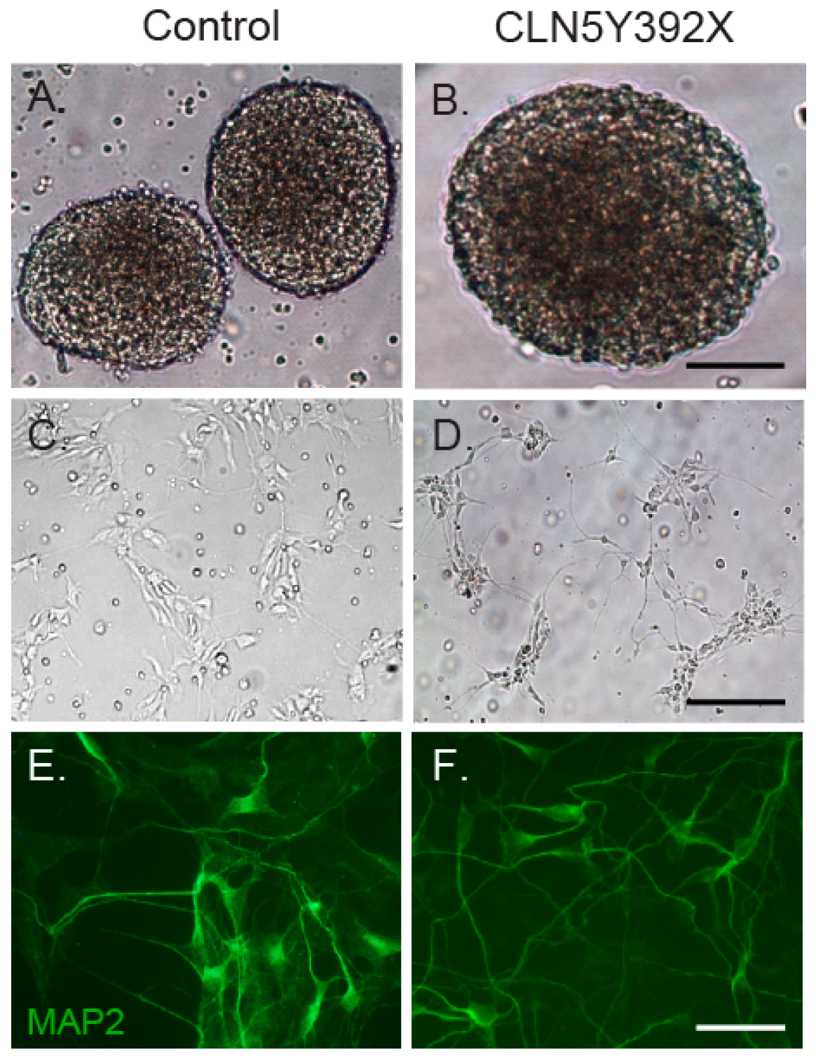 Ijms 18 00955 g002