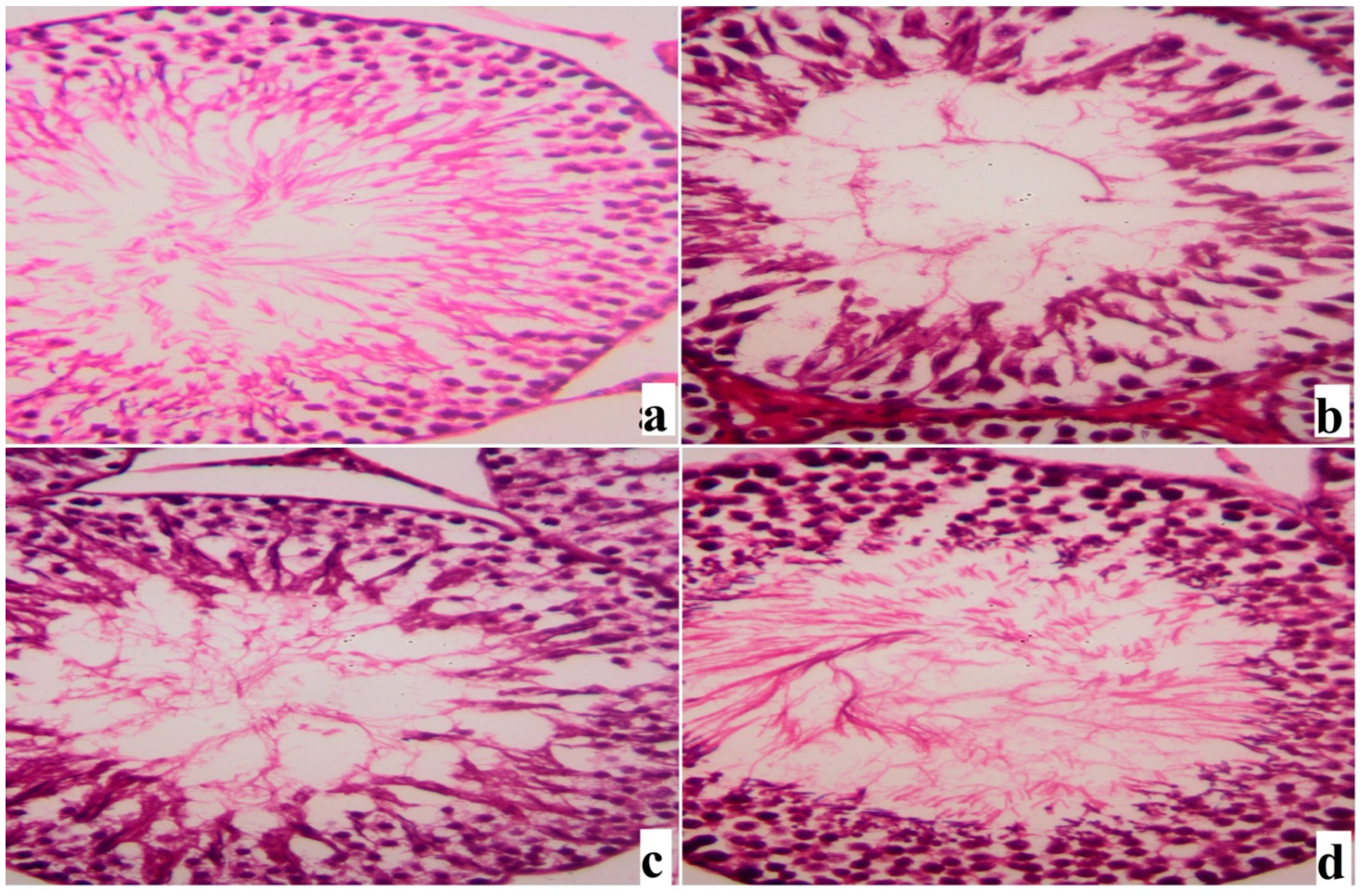 Ijms 18 00957 g007