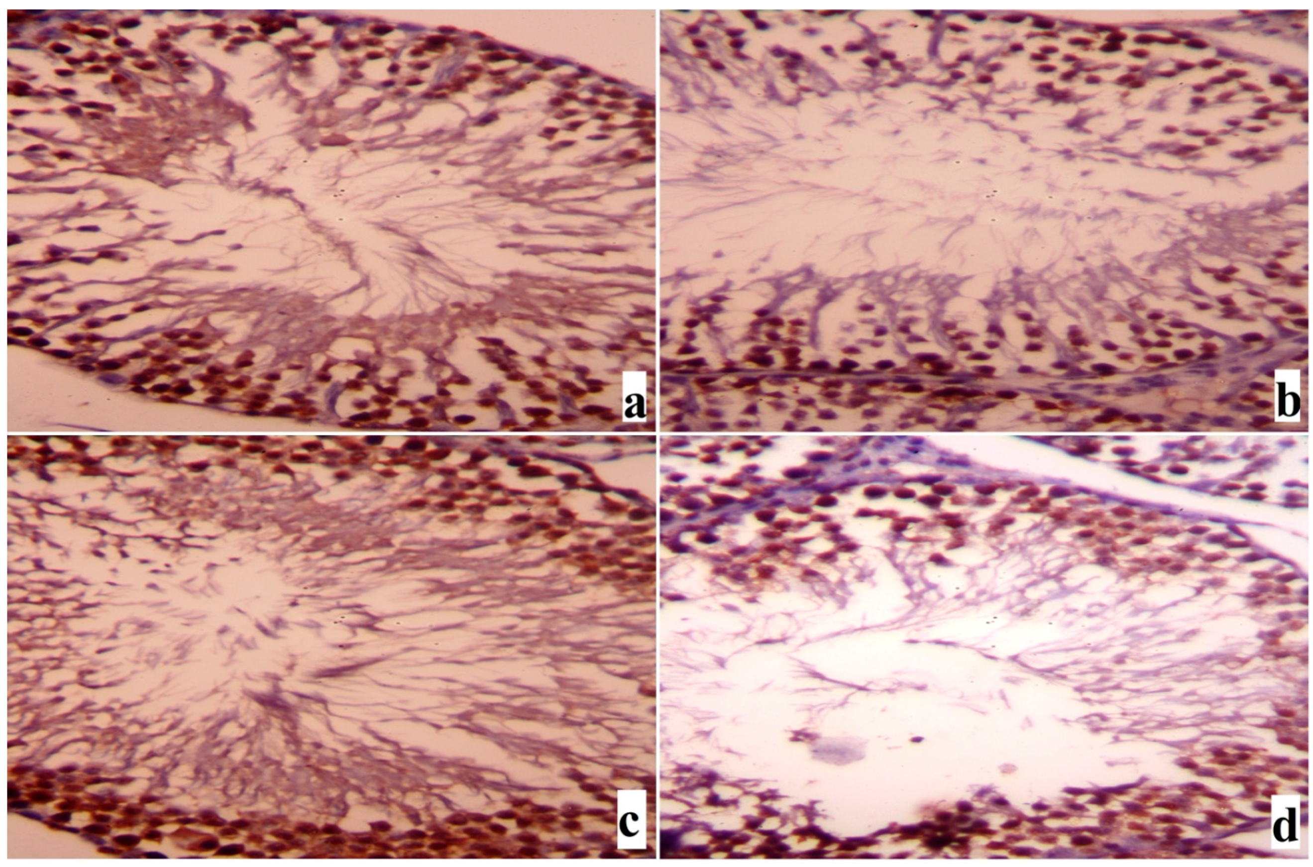 Ijms 18 00957 g010
