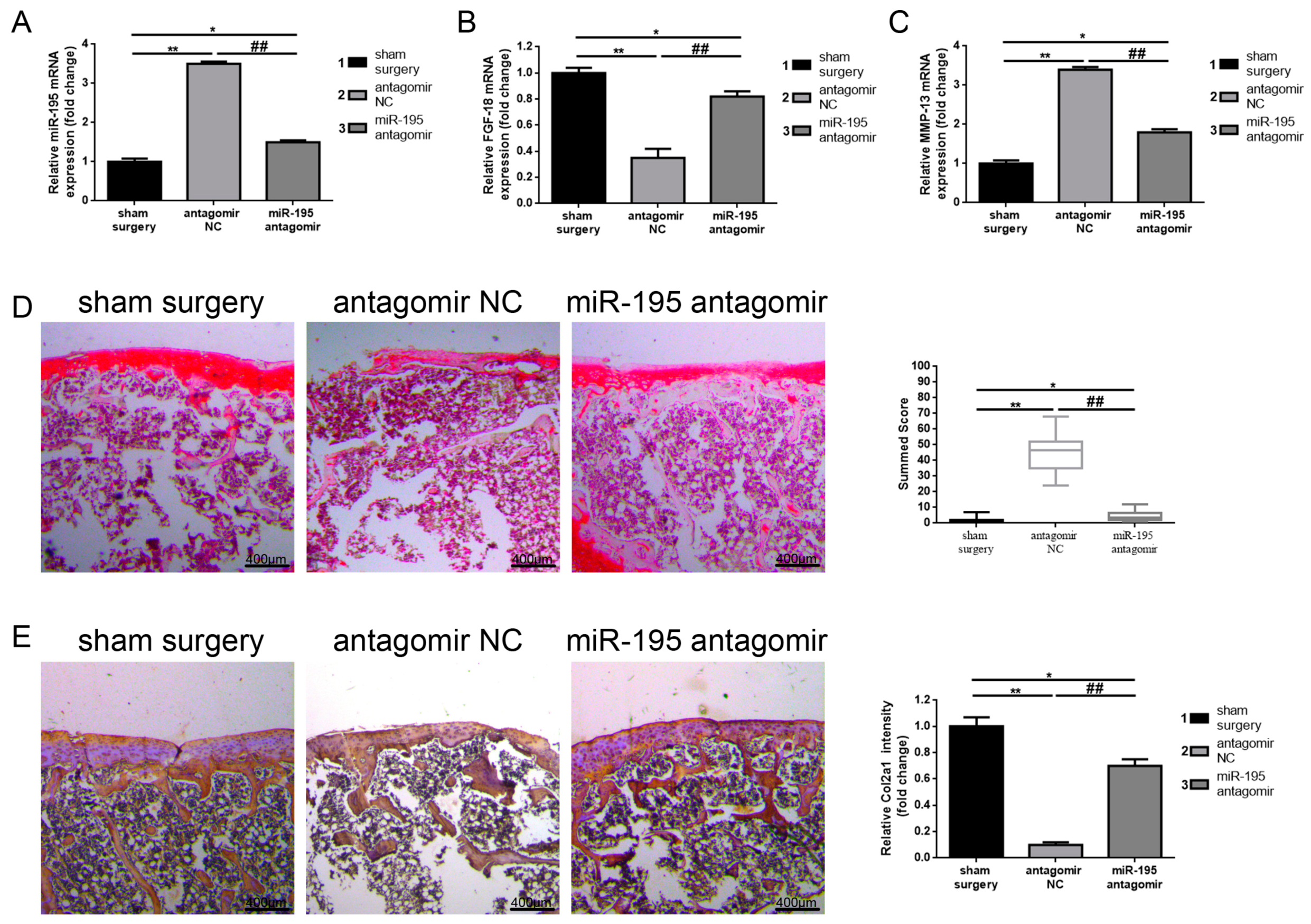 Ijms 18 00975 g005a 550