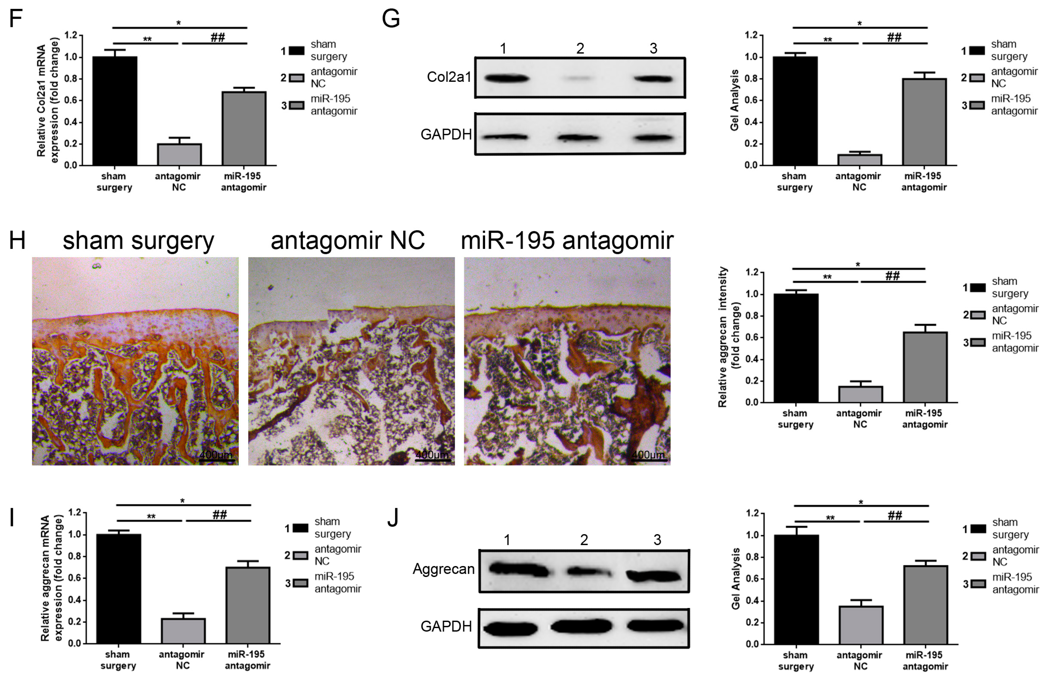 Ijms 18 00975 g005b 550
