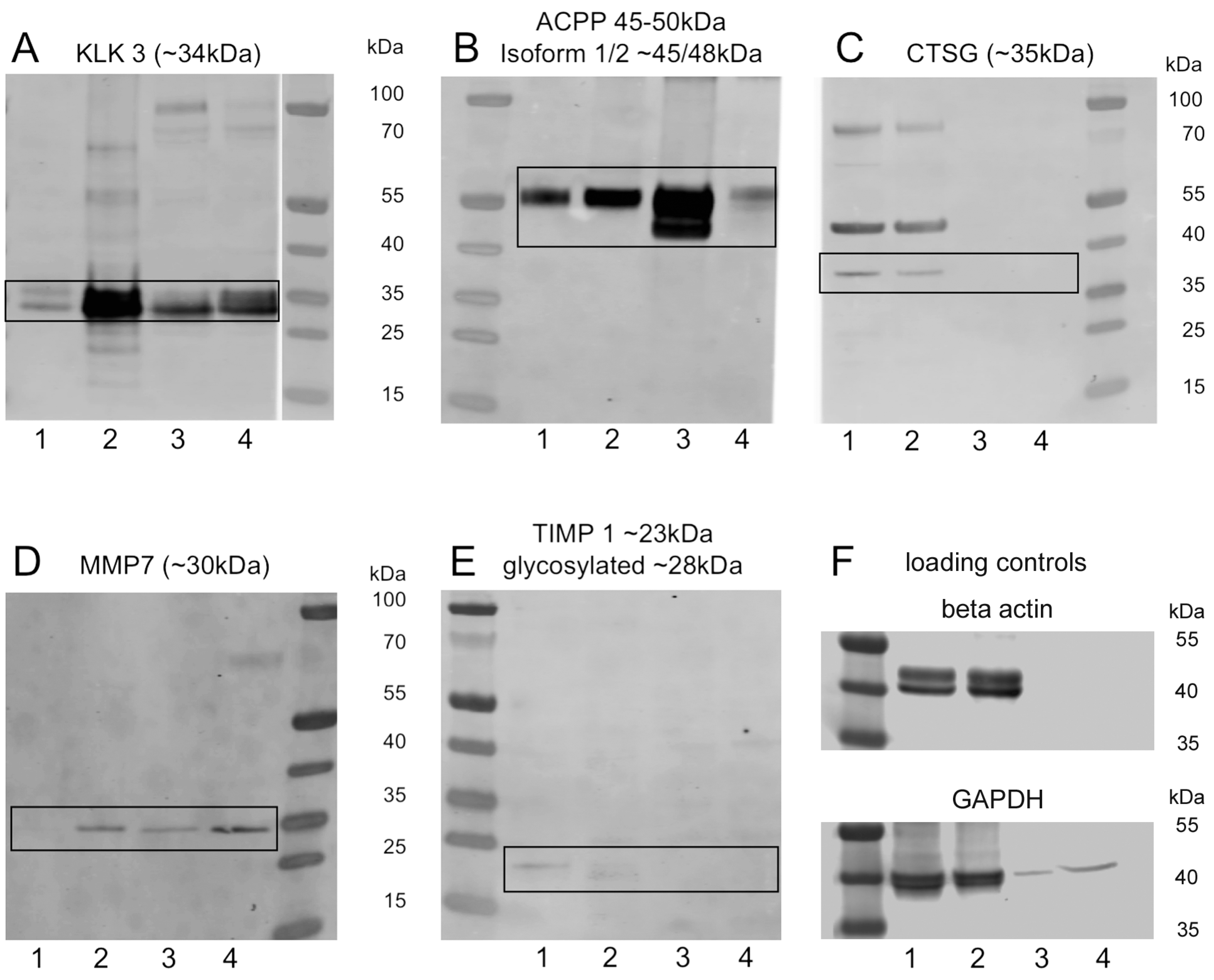 Ijms 18 00976 g002 550