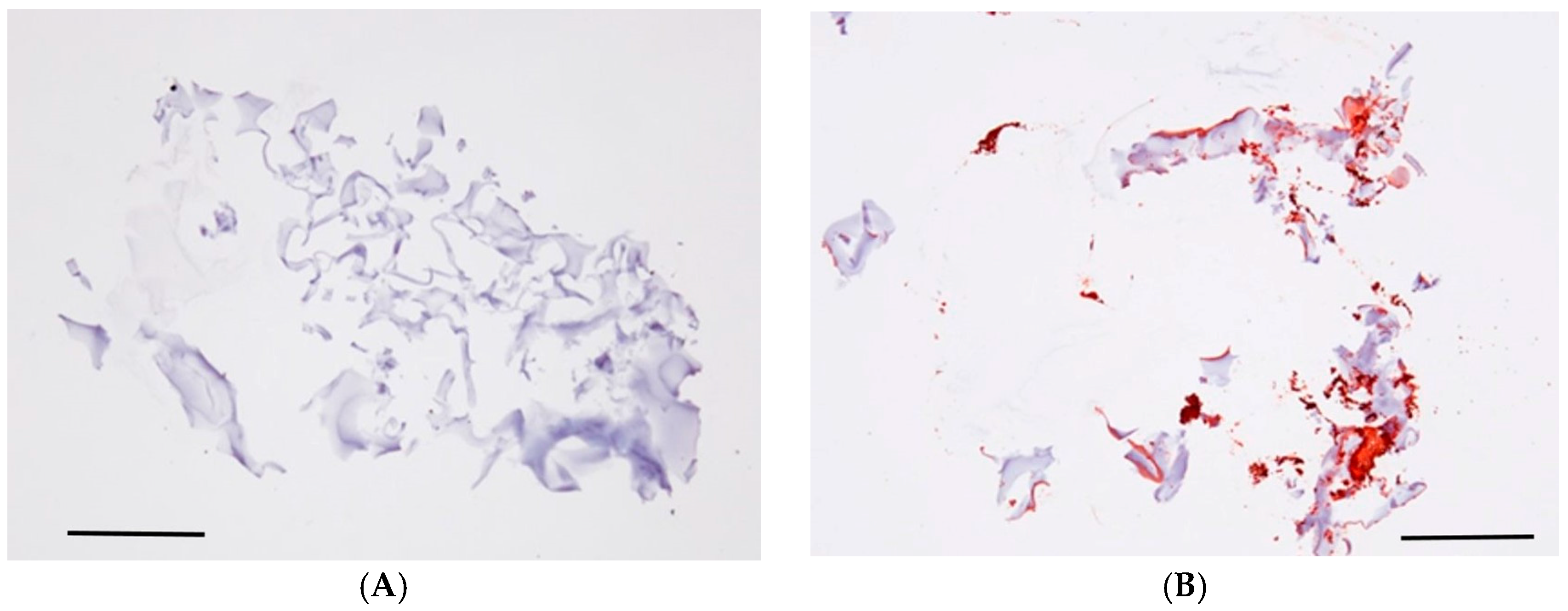 Ijms 18 00985 g001 550