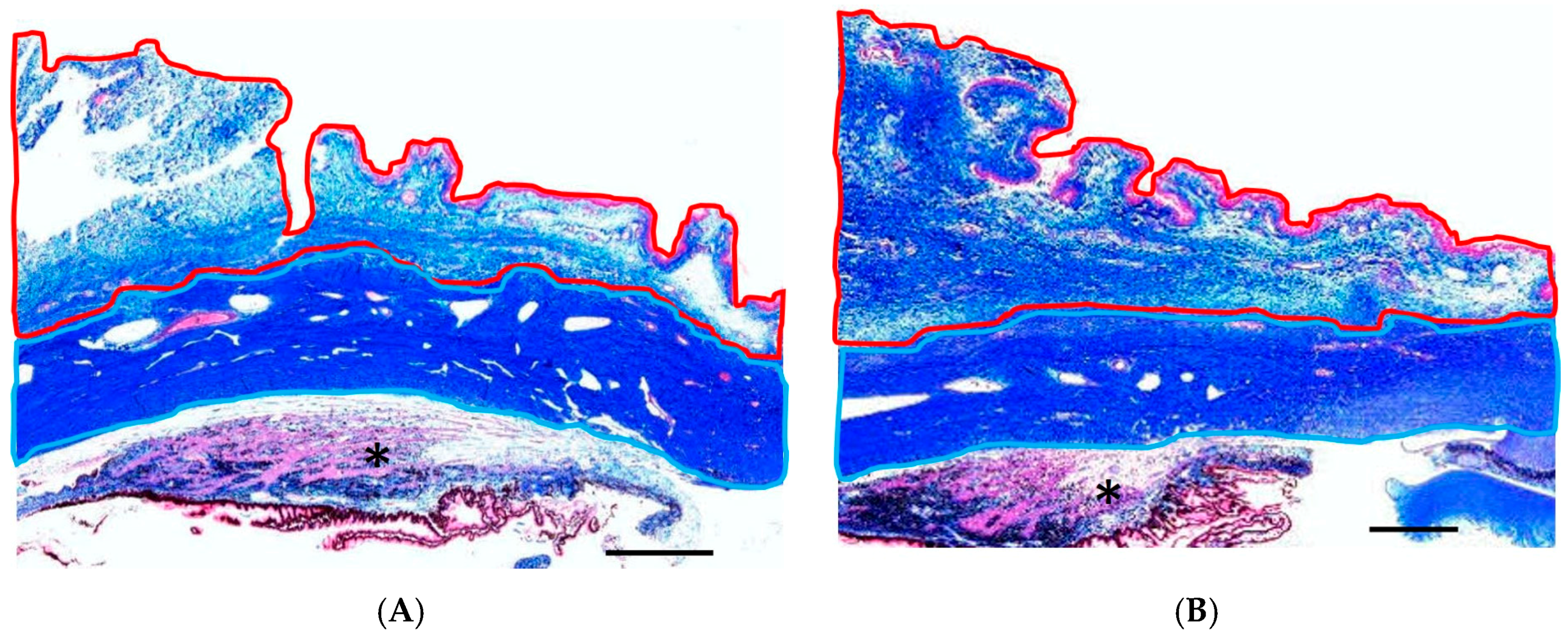 Ijms 18 00985 g004 550