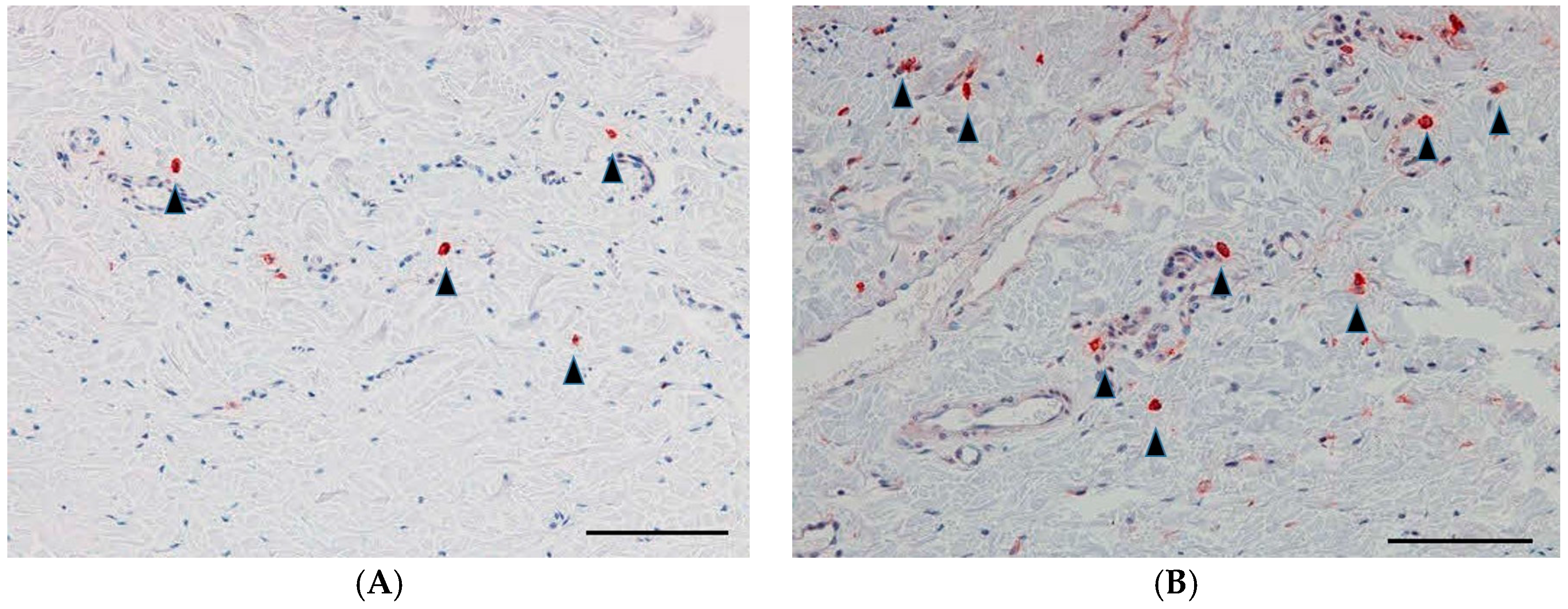 Ijms 18 00985 g006 550