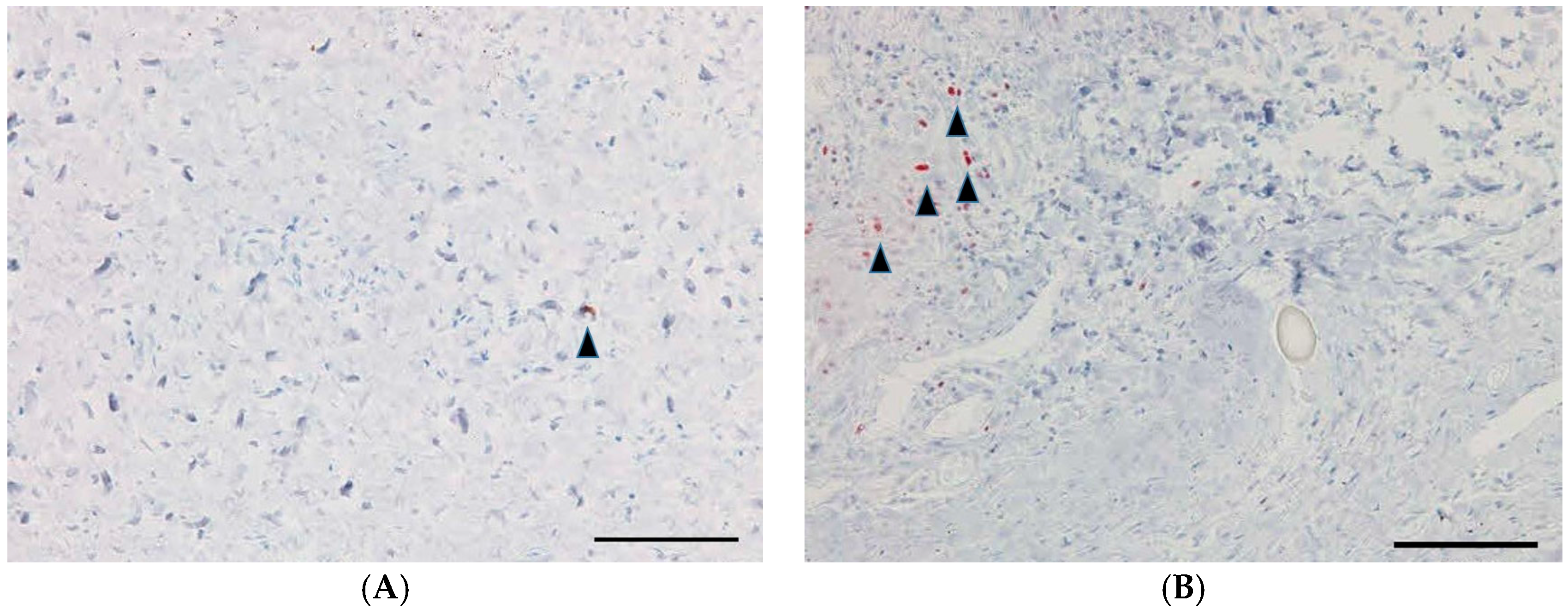 Ijms 18 00985 g007 550