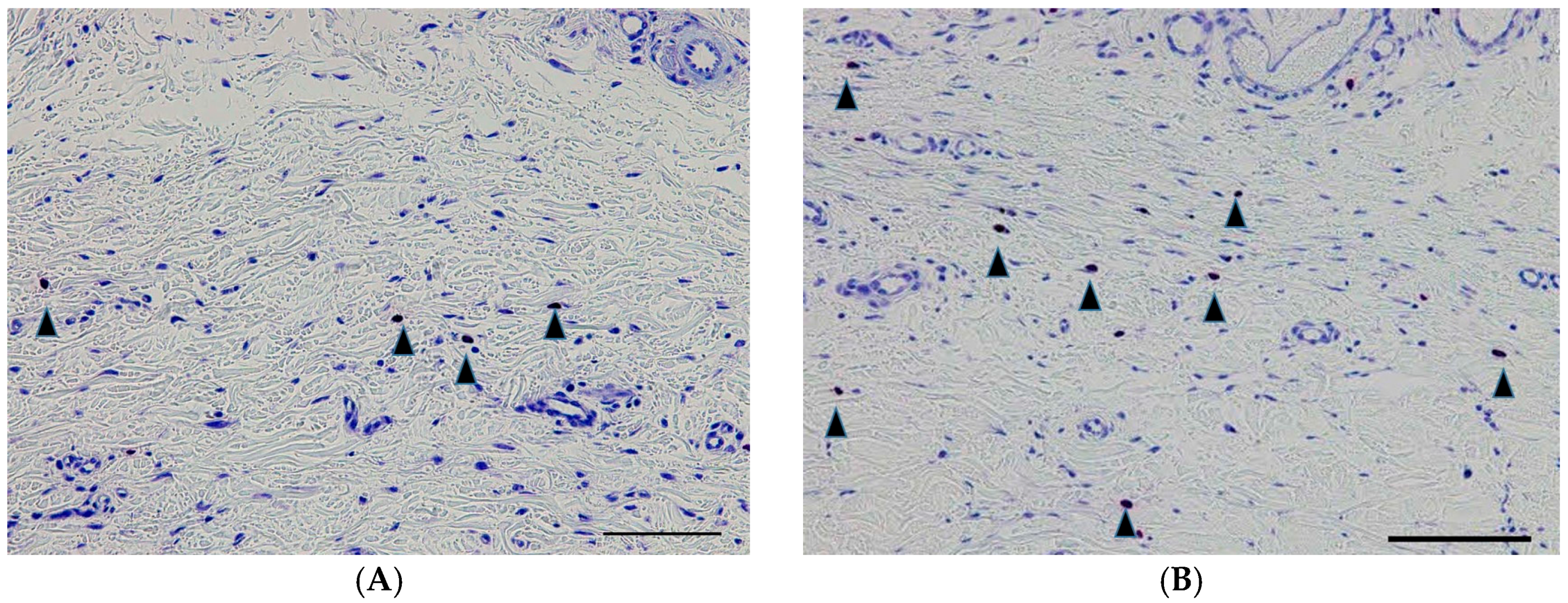 Ijms 18 00985 g008 550