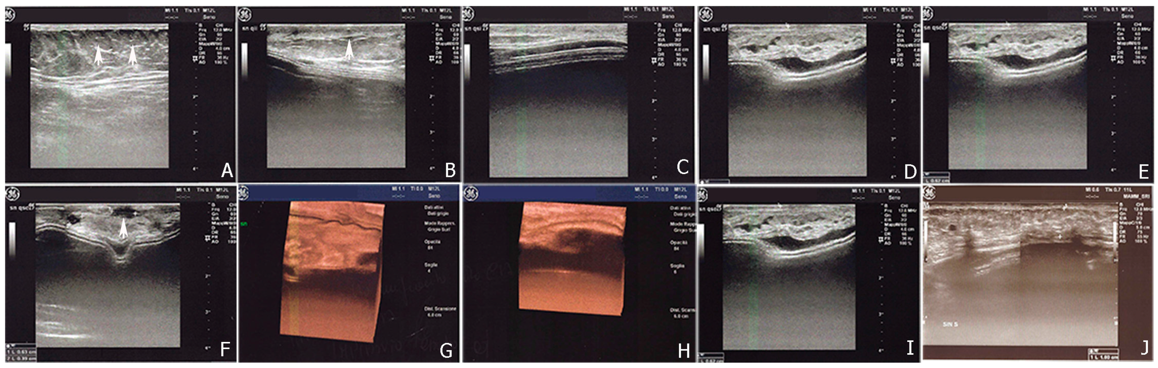 Ijms 18 01038 g006