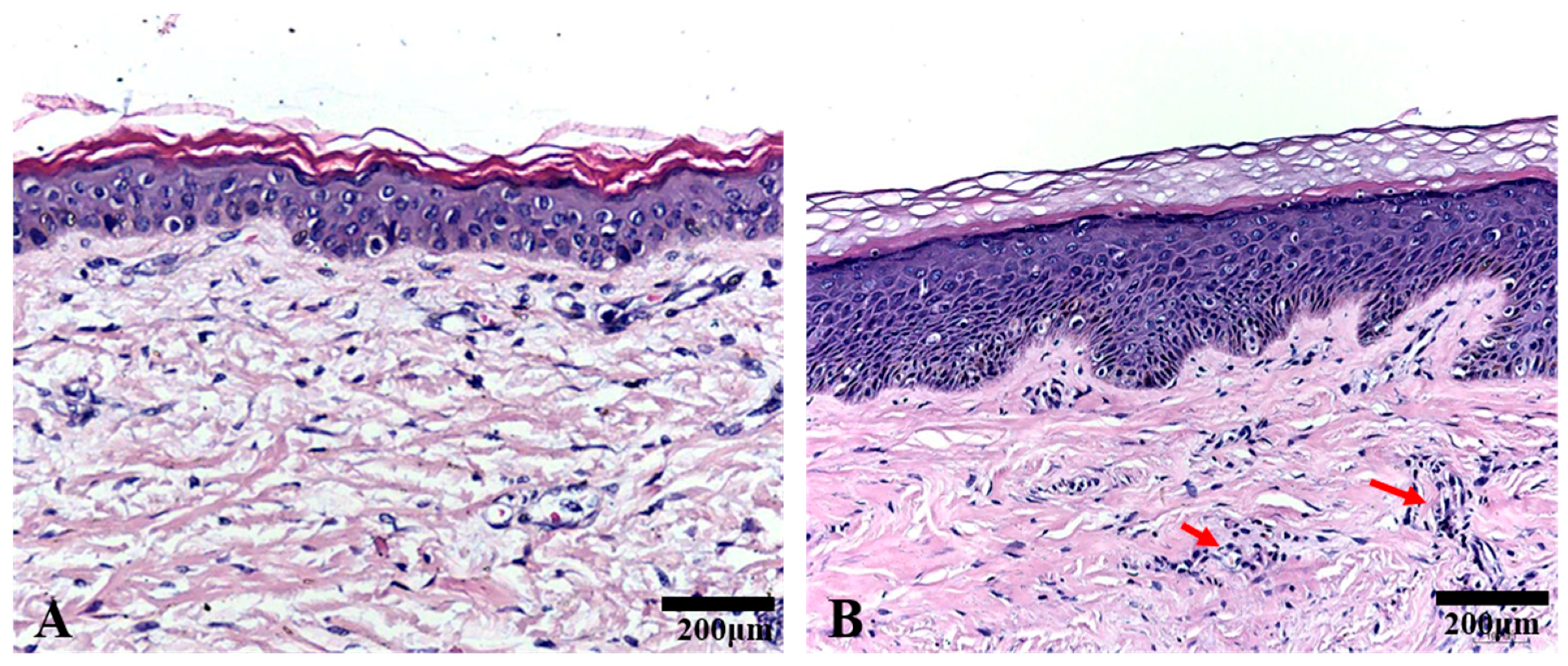 Ijms 18 01044 g001 550