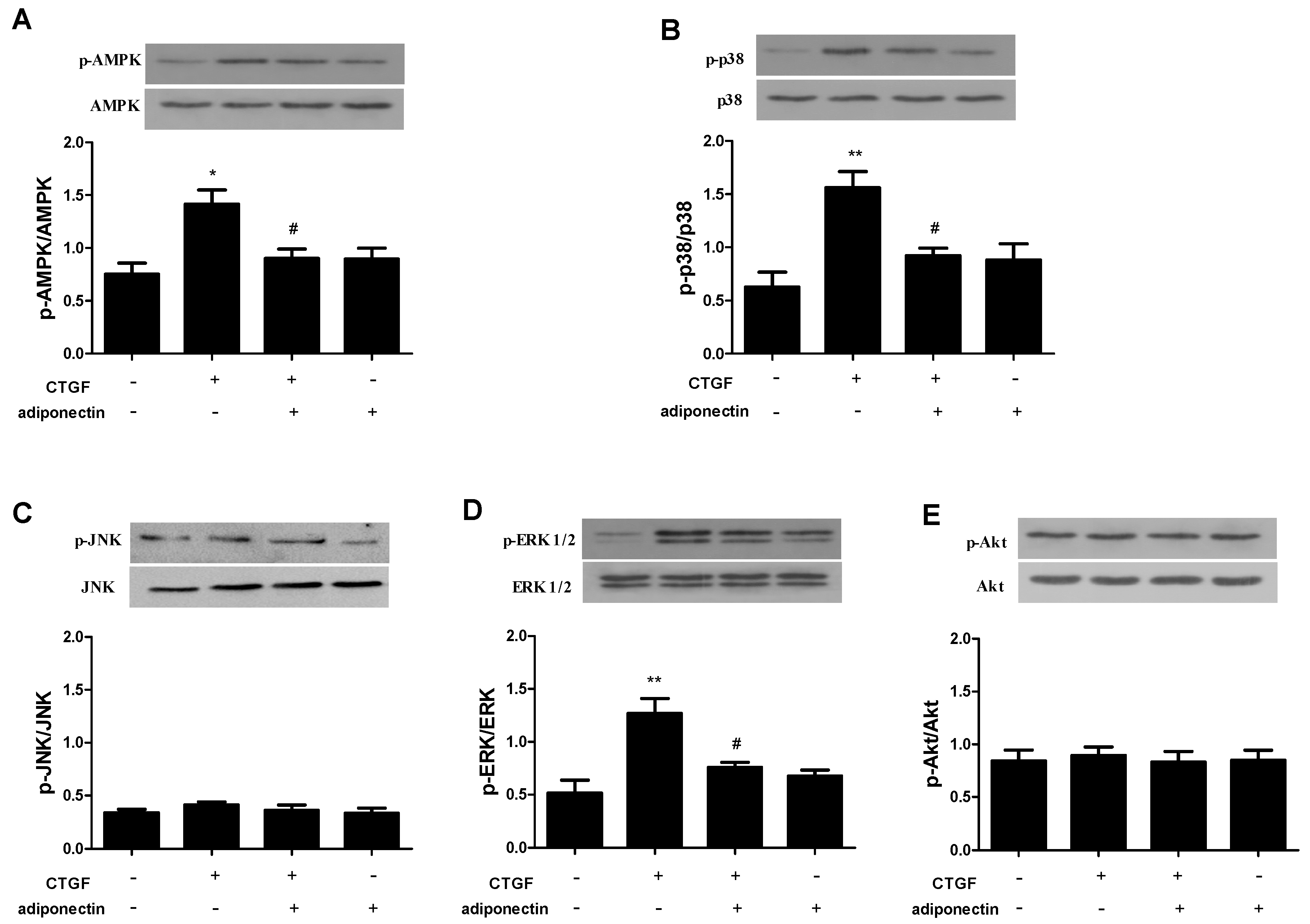 Ijms 18 01044 g005 550