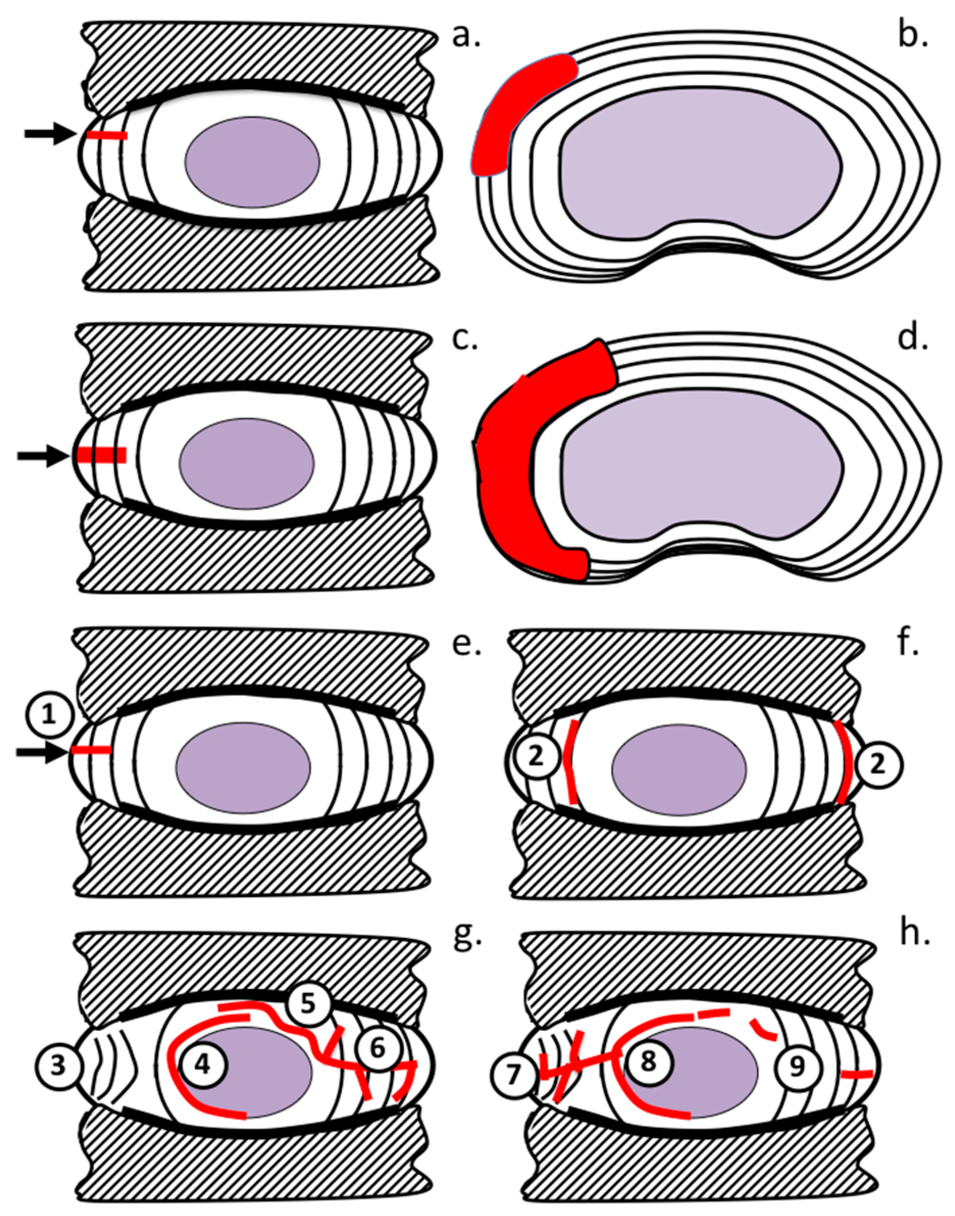 Ijms 18 01049 g004 550