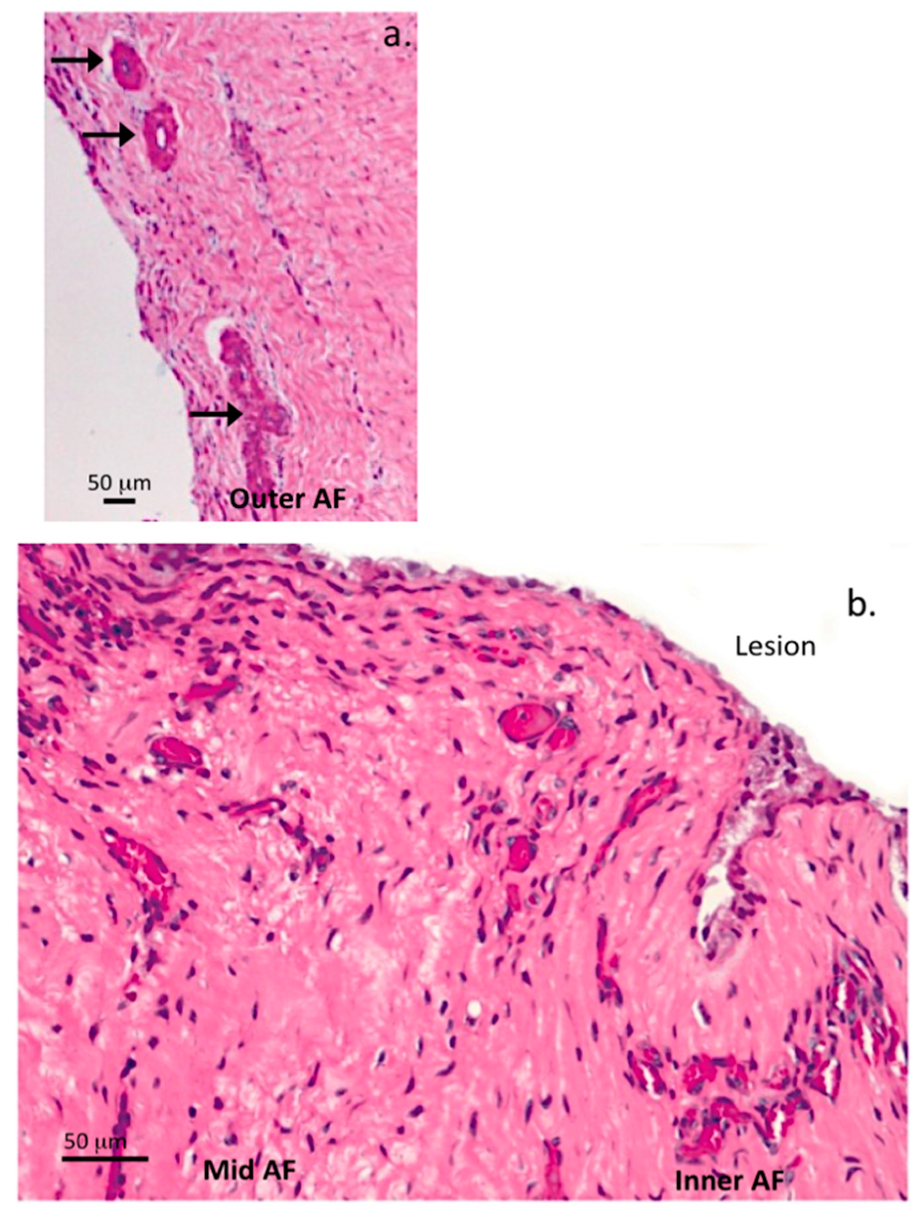 Ijms 18 01049 g008 550