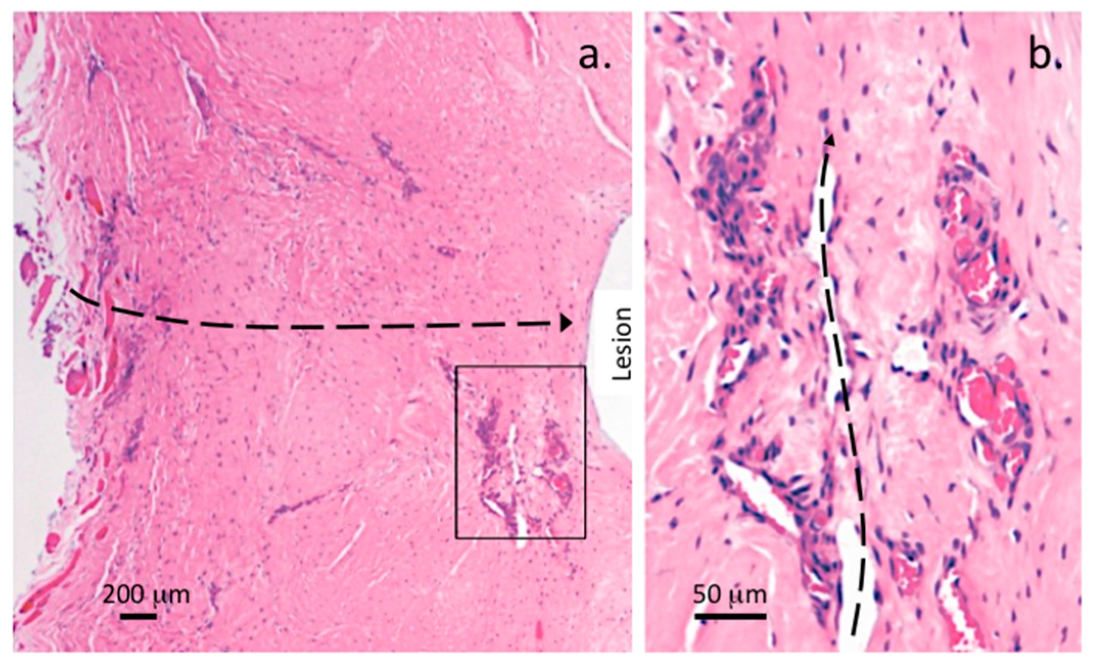 Ijms 18 01049 g010a 550