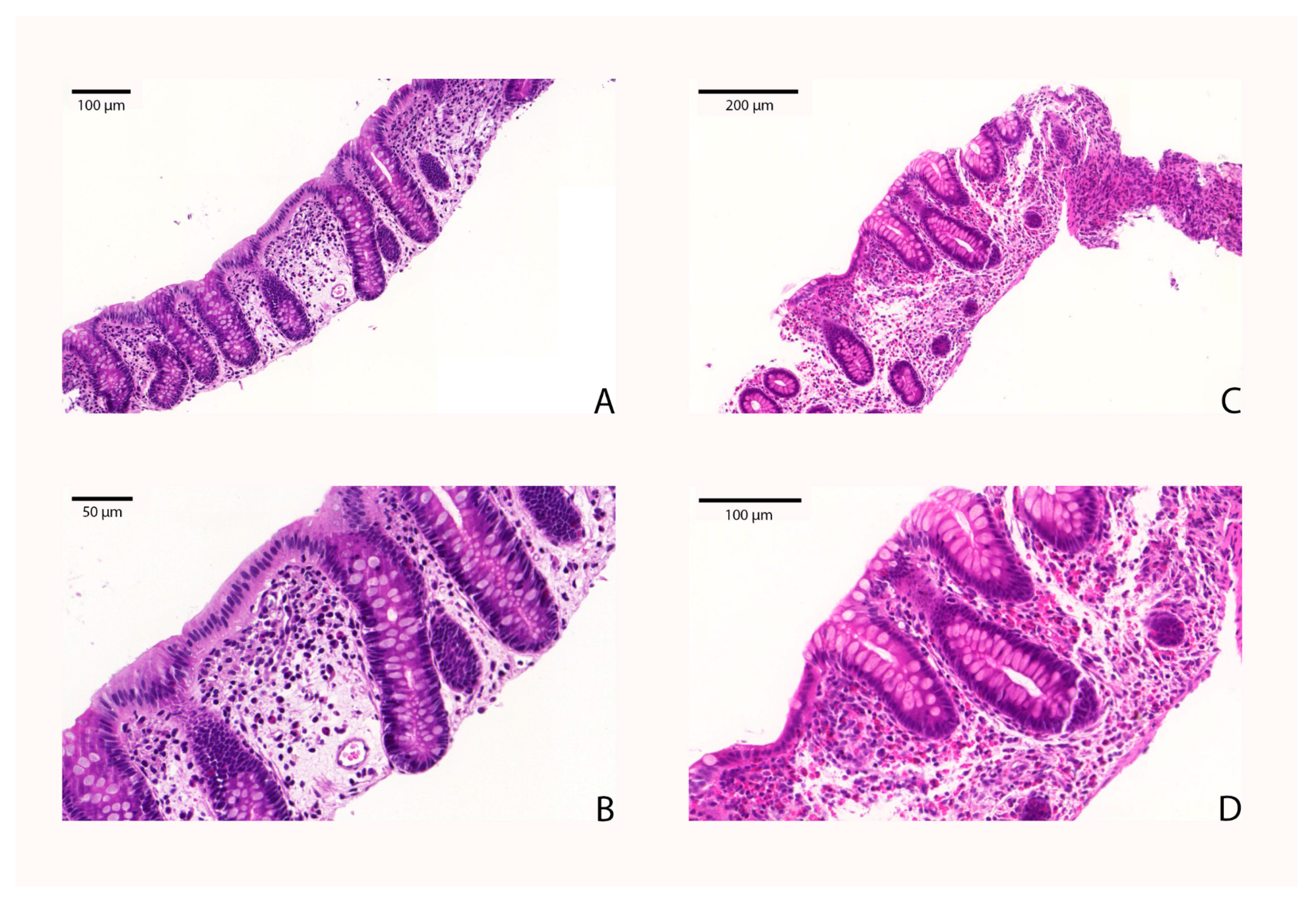 Ijms 18 01050 g005 550