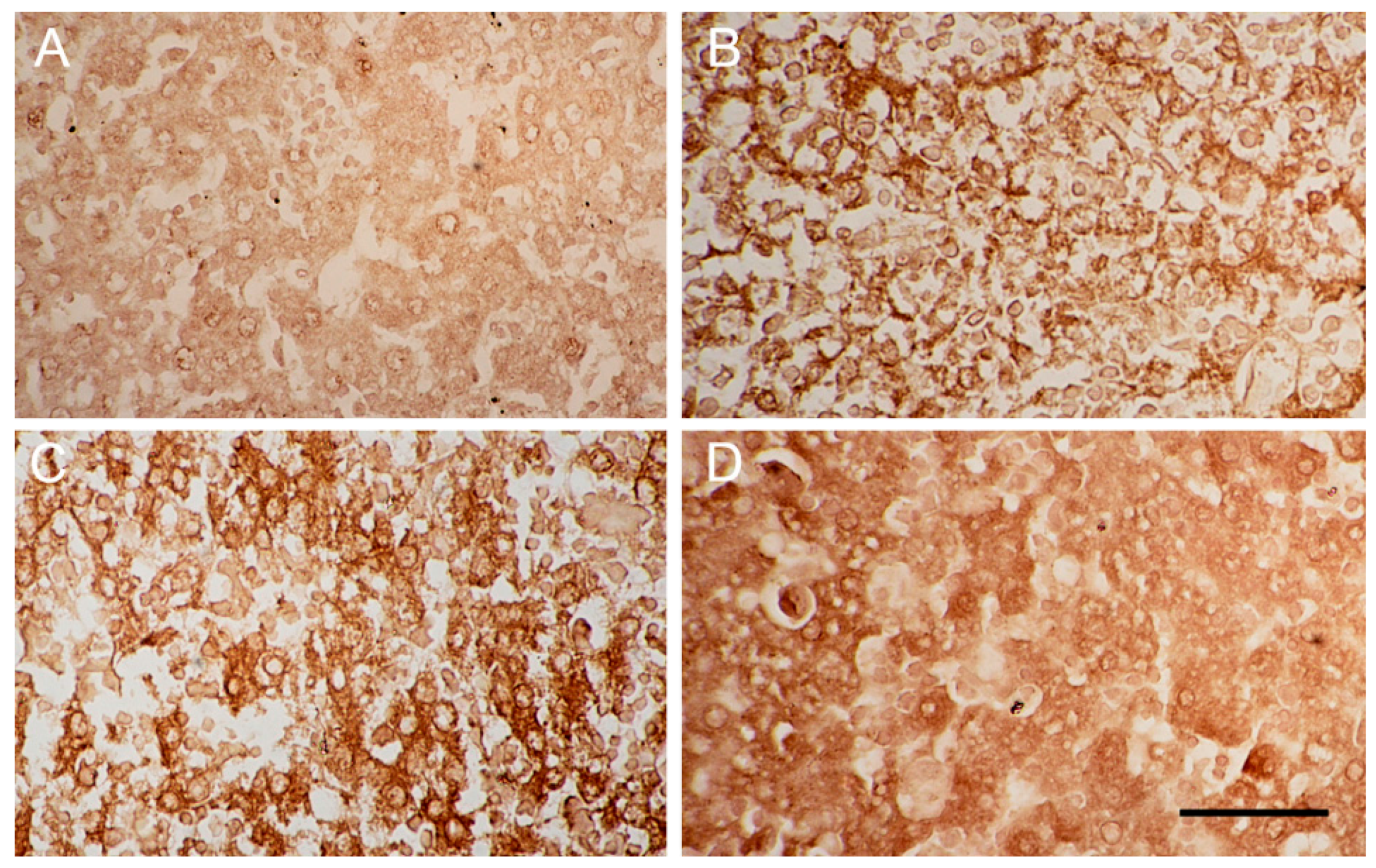 Ijms 18 01098 g005