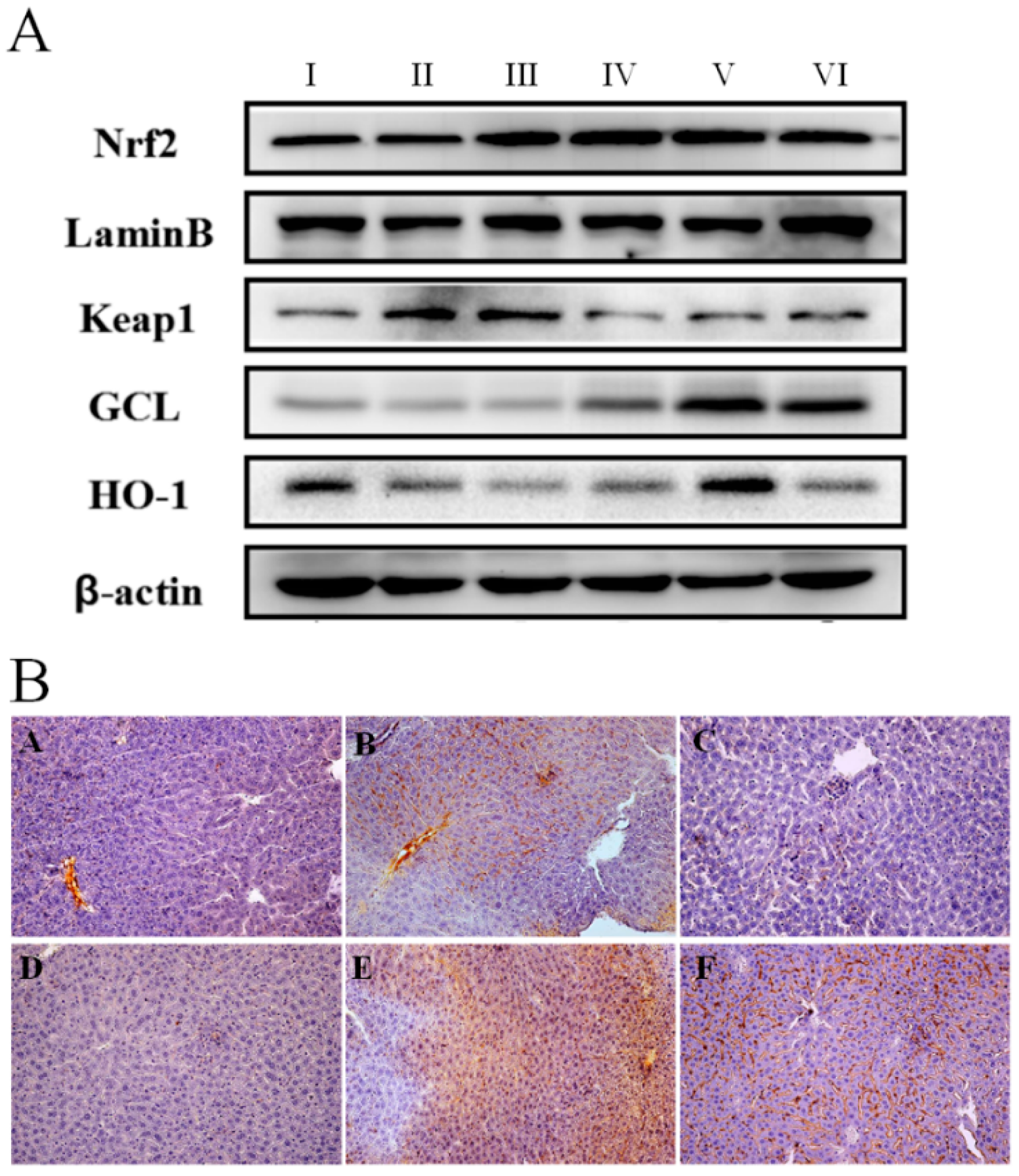 Ijms 18 01197 g004
