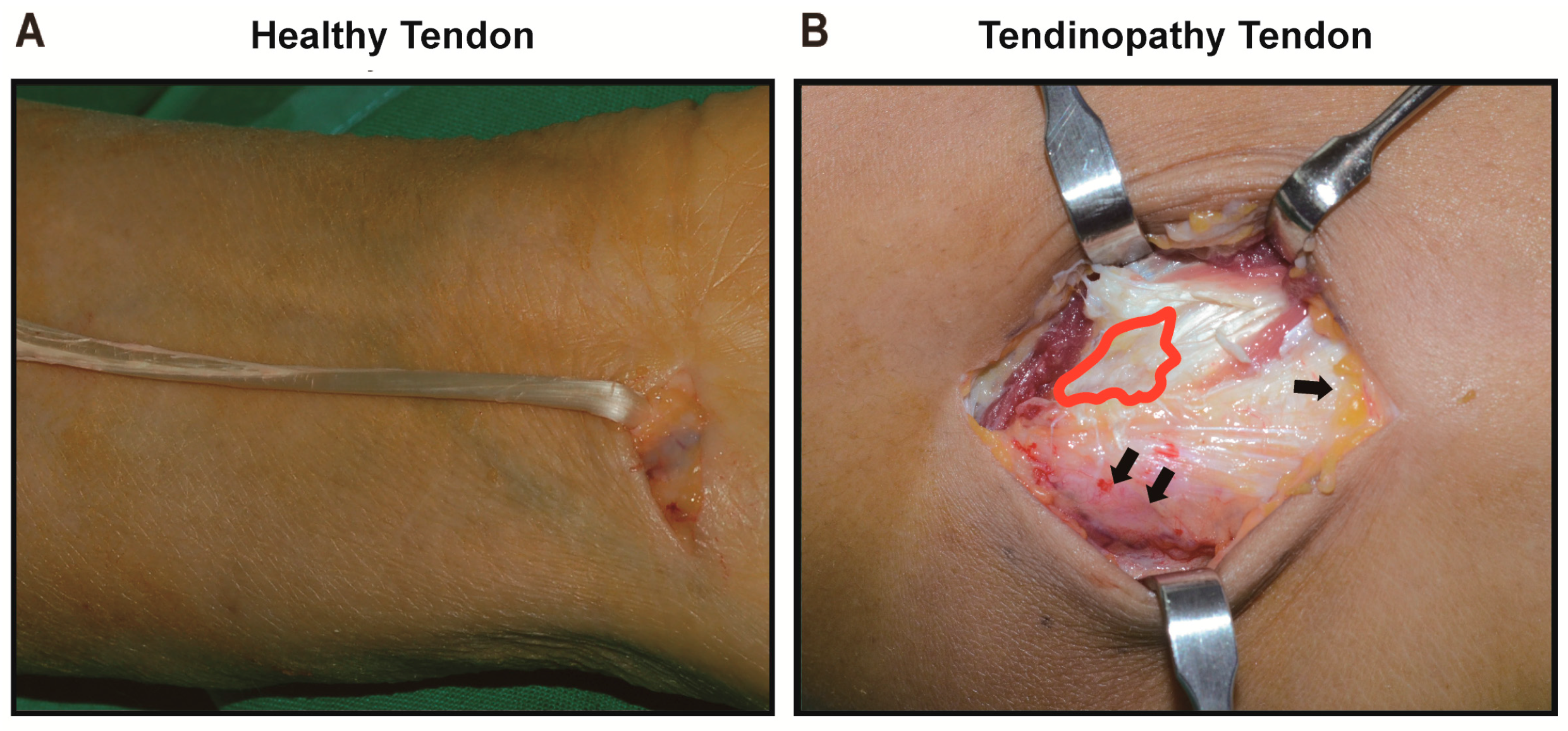 Ijms 18 01241 g007 550