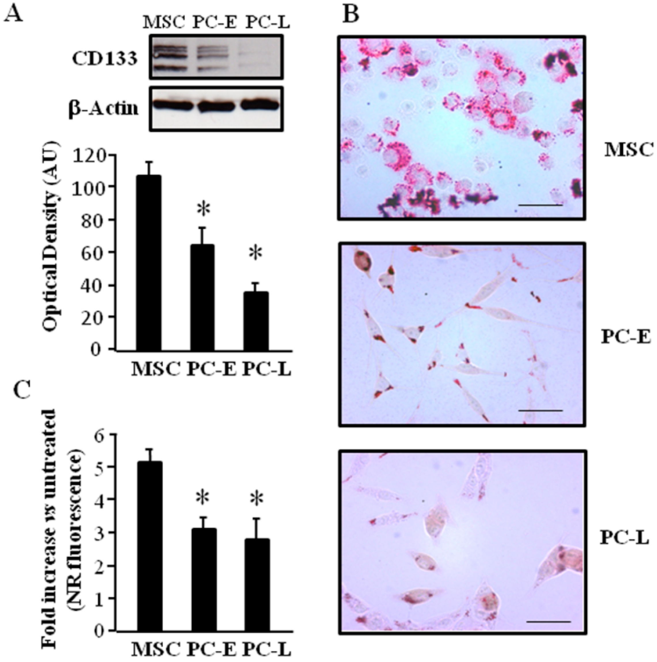 Ijms Free Full Text Lipid Storage And Autophagy In Melanoma Cancer Cells Html