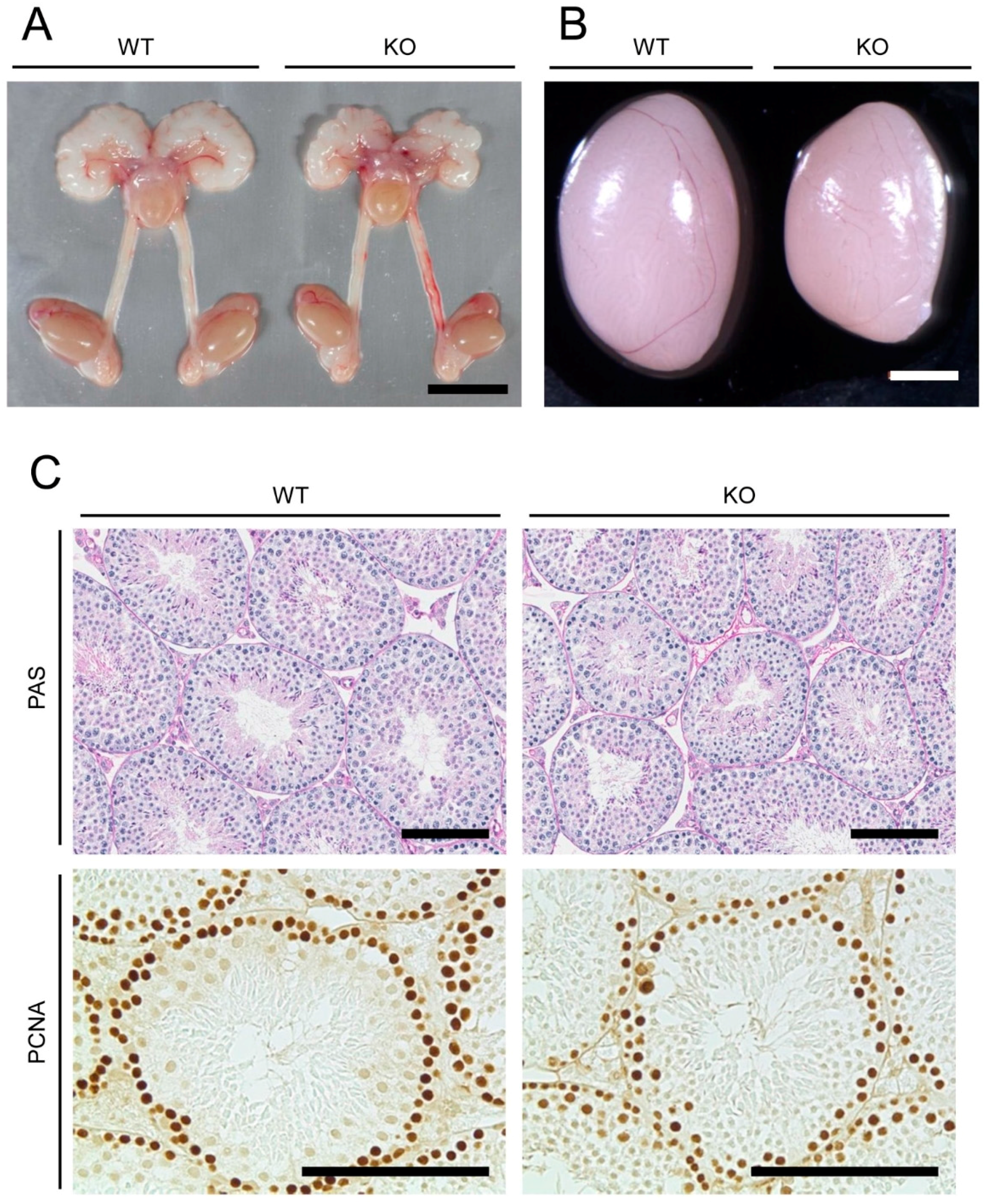 normal-sperm-production