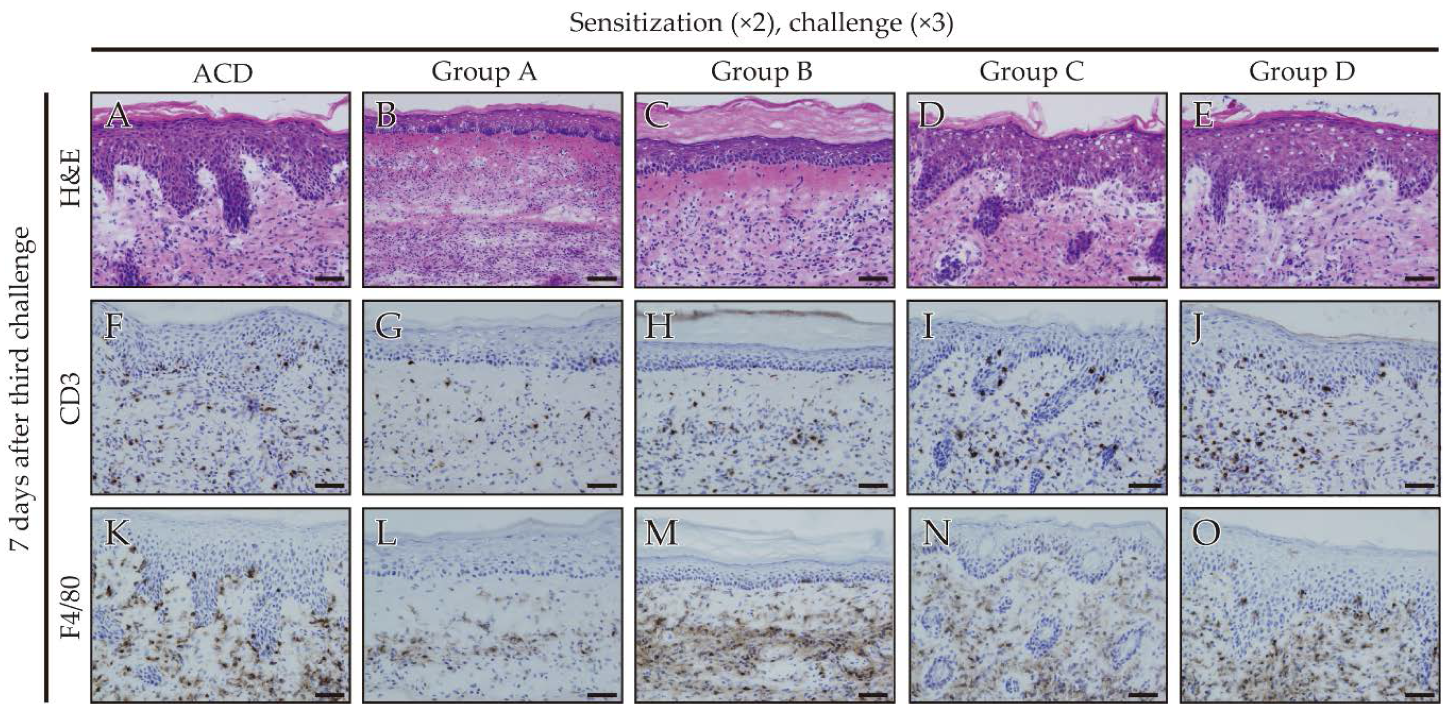 Ijms 18 01357 g004 550